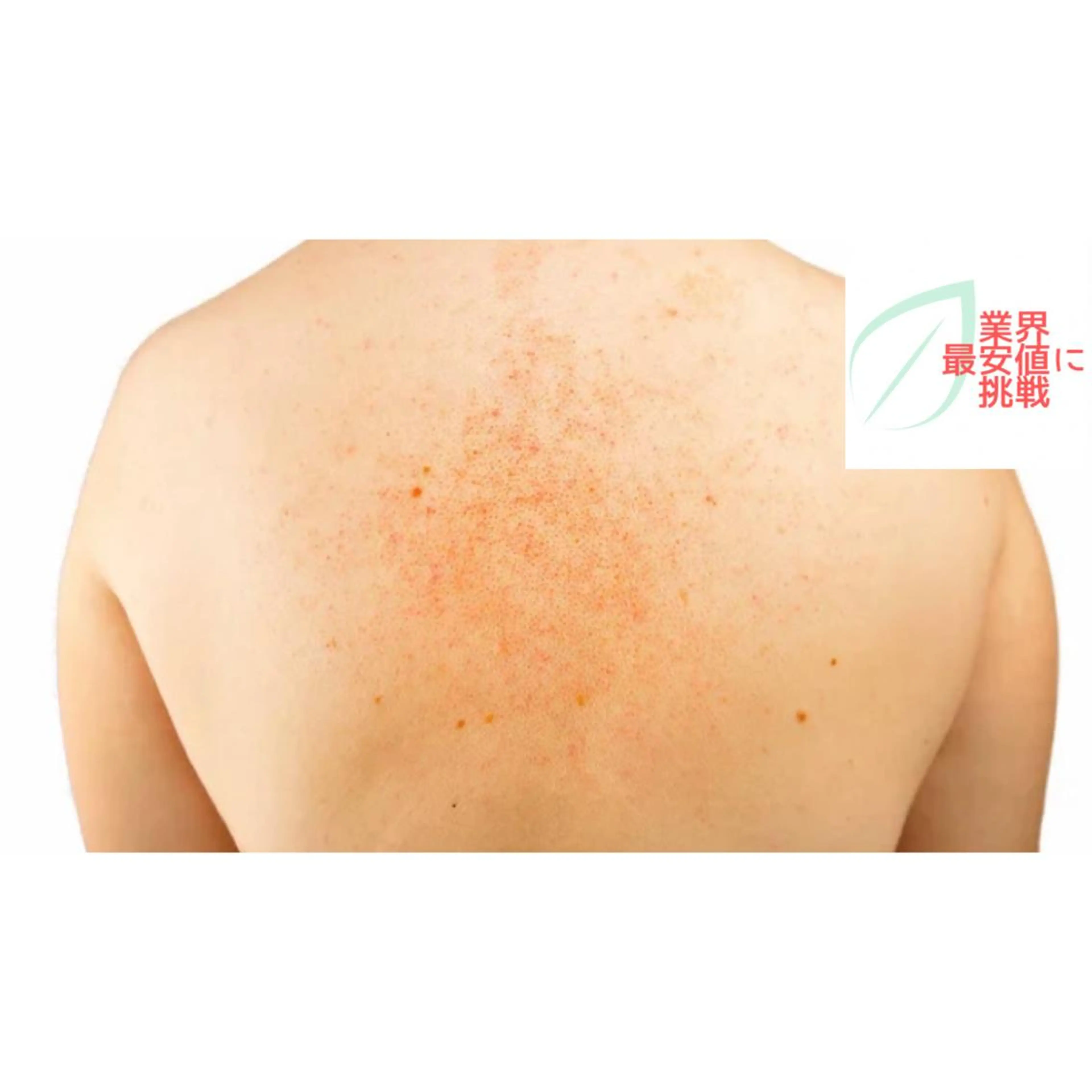 エステ サロンド エルのエステ・リラクイメージ