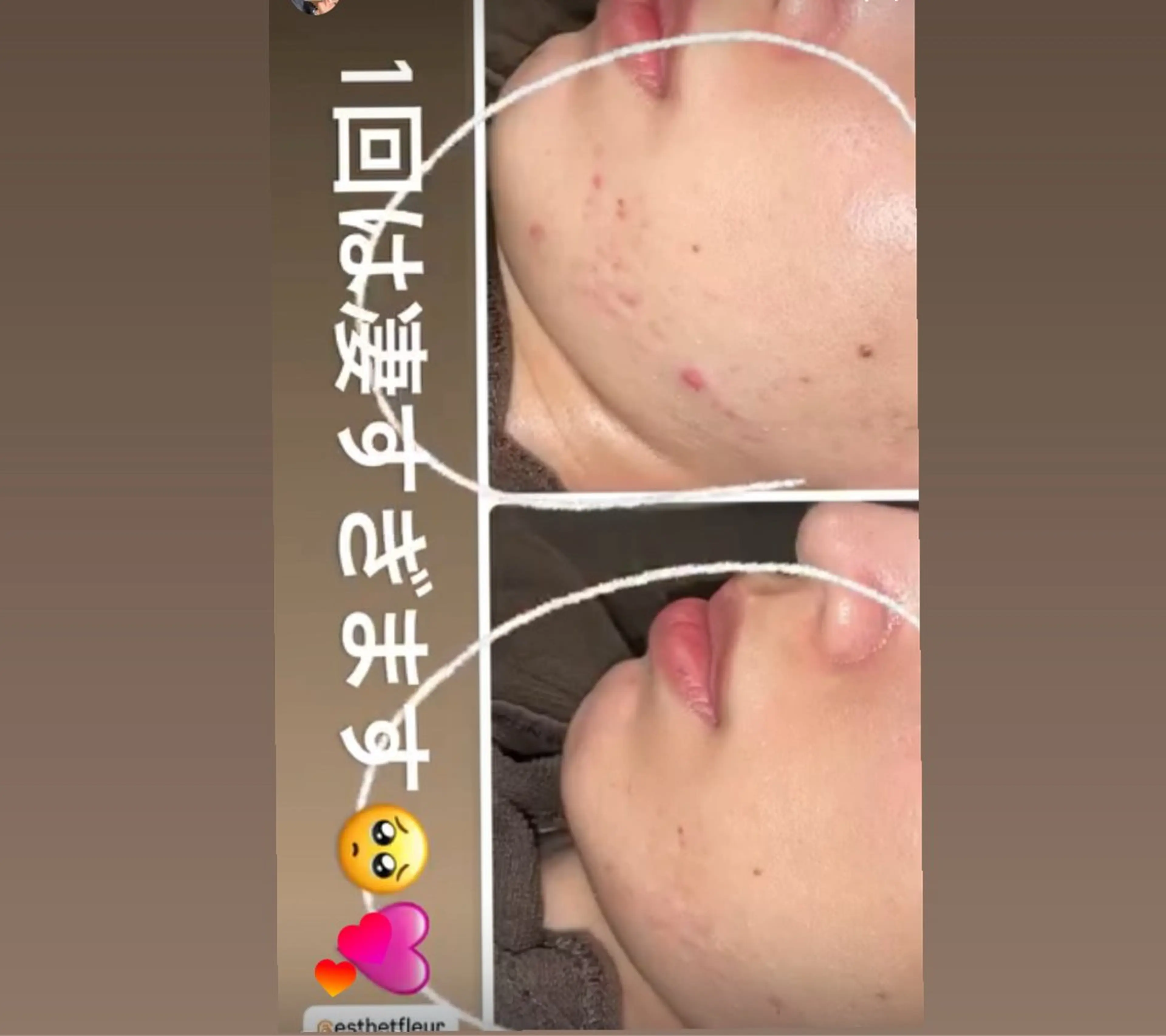 FLEUR 2号店のエステ・リラクイメージ