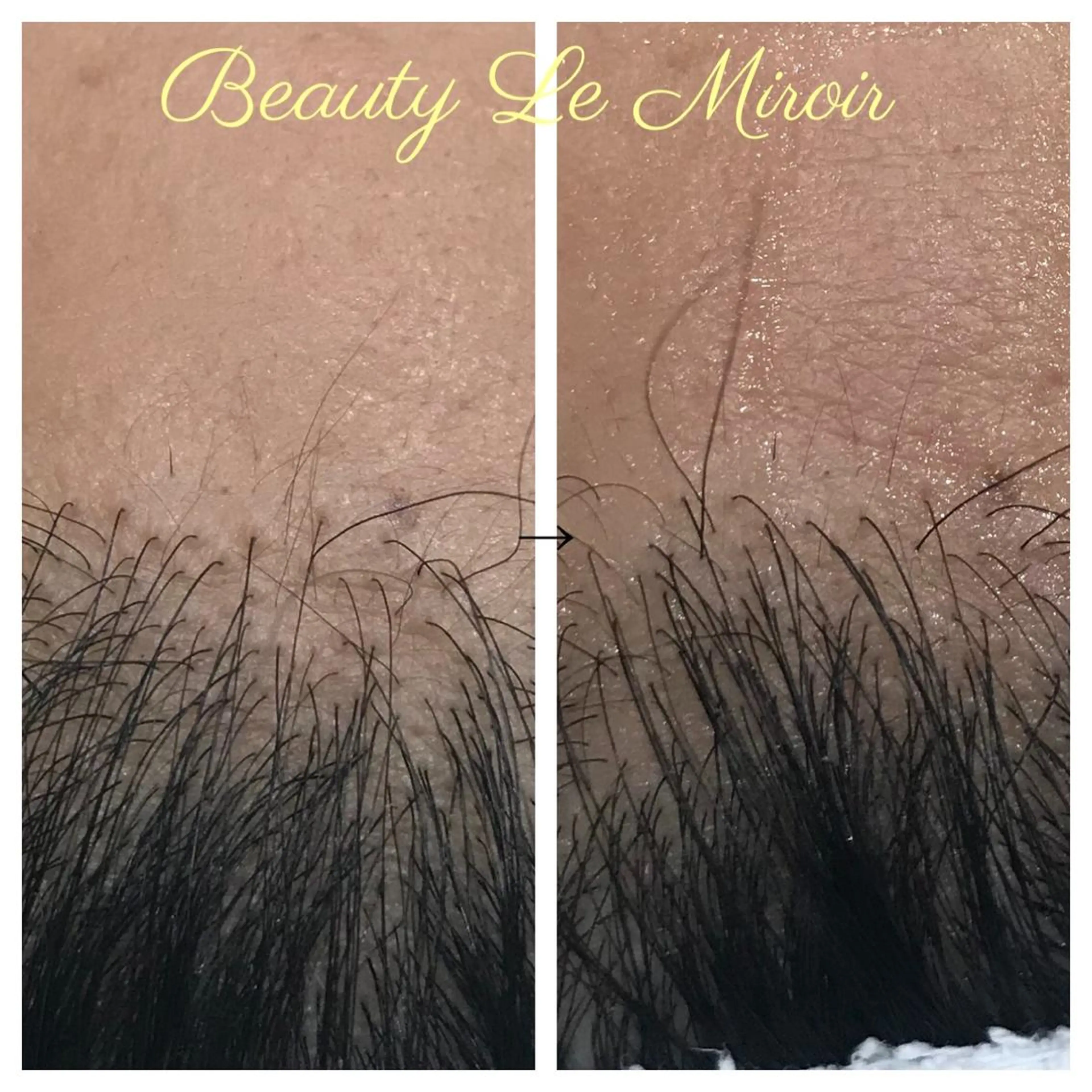 ビューティー ミロワールのエステ・リラクイメージ