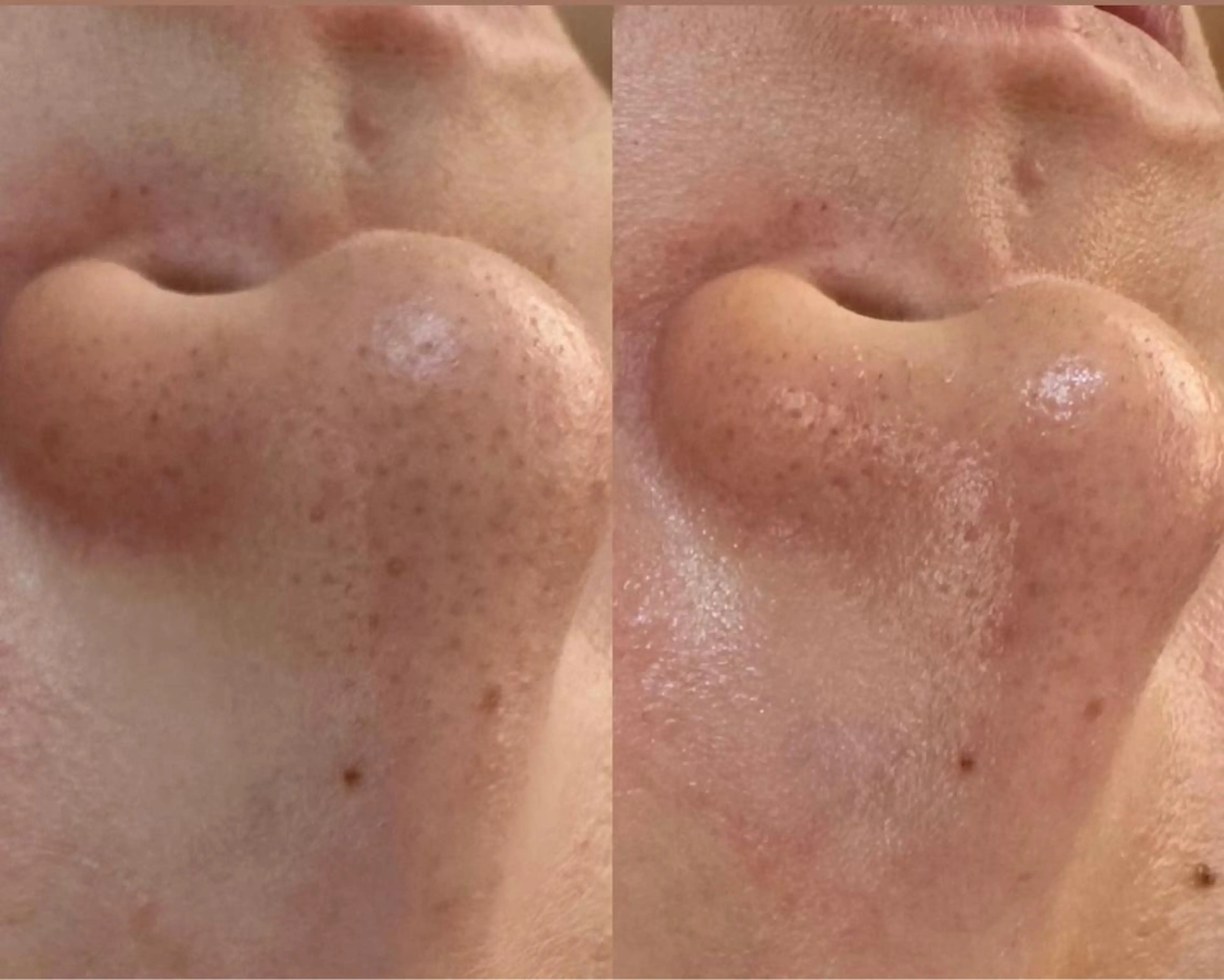 エステ MARIRE EPISALONのエステ・リラクイメージ