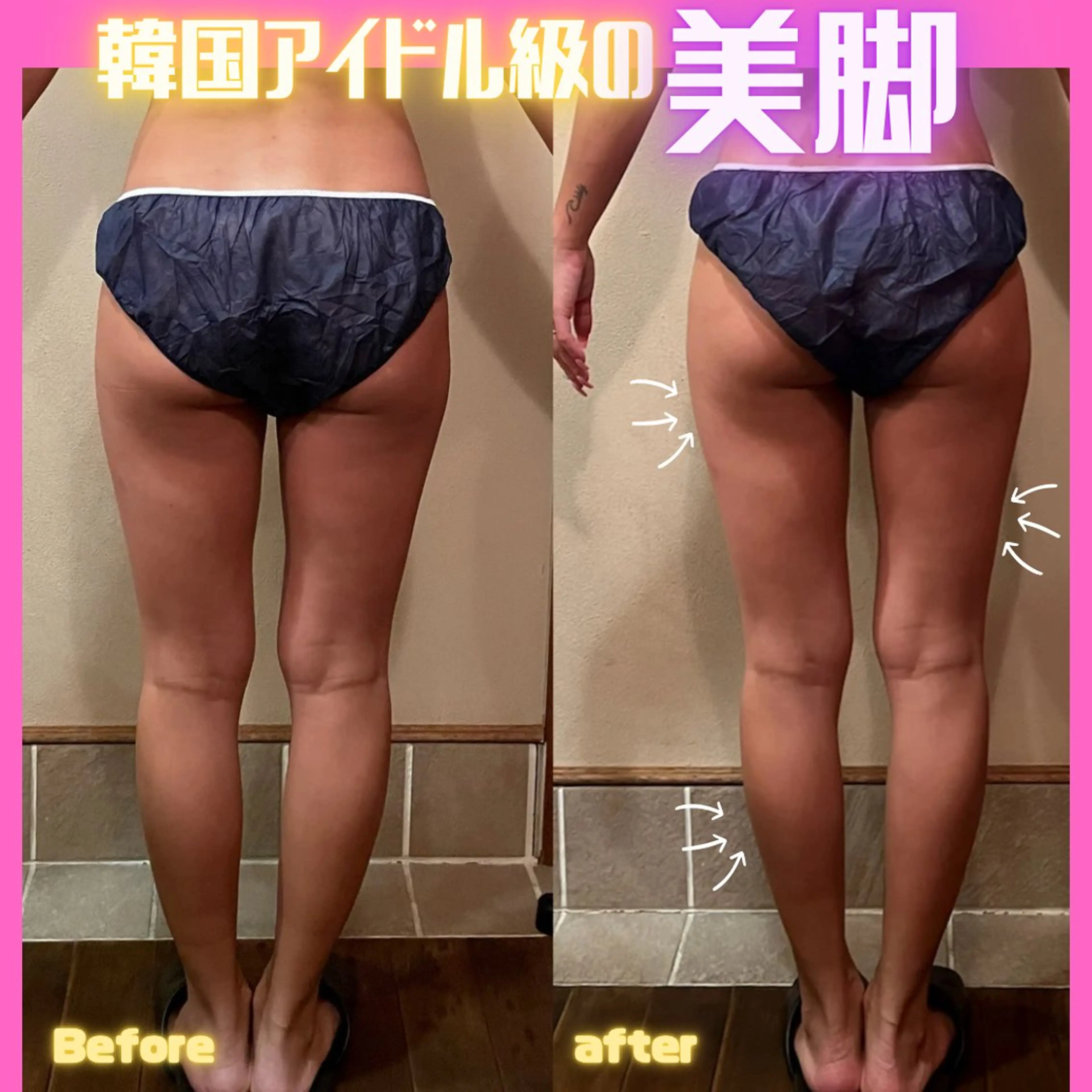 痩身&美肌サロン 堀米✨のその他イメージ