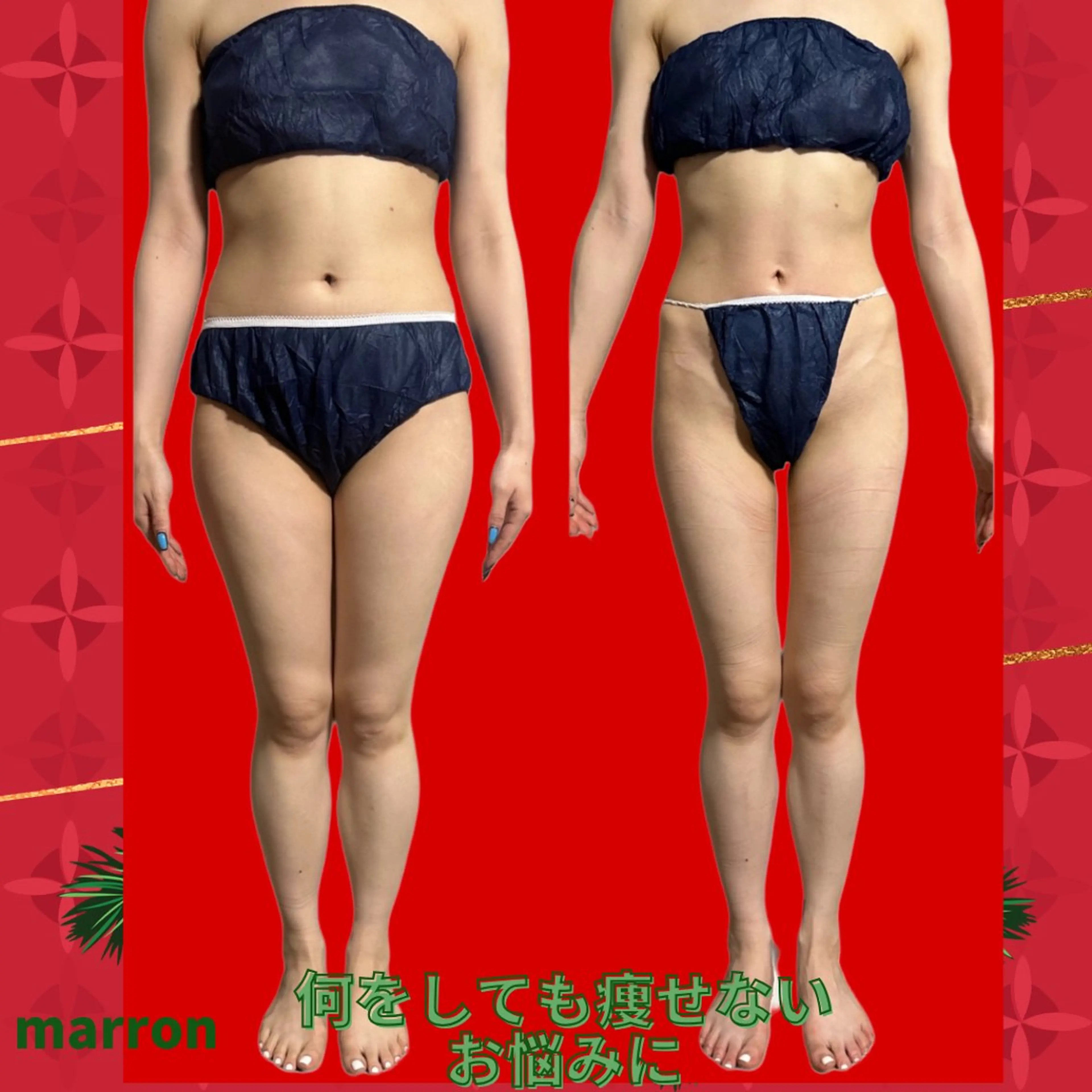 marron所属・痩身ハイパーナイフ ララピールリアボーテのエステ・リラクイメージ