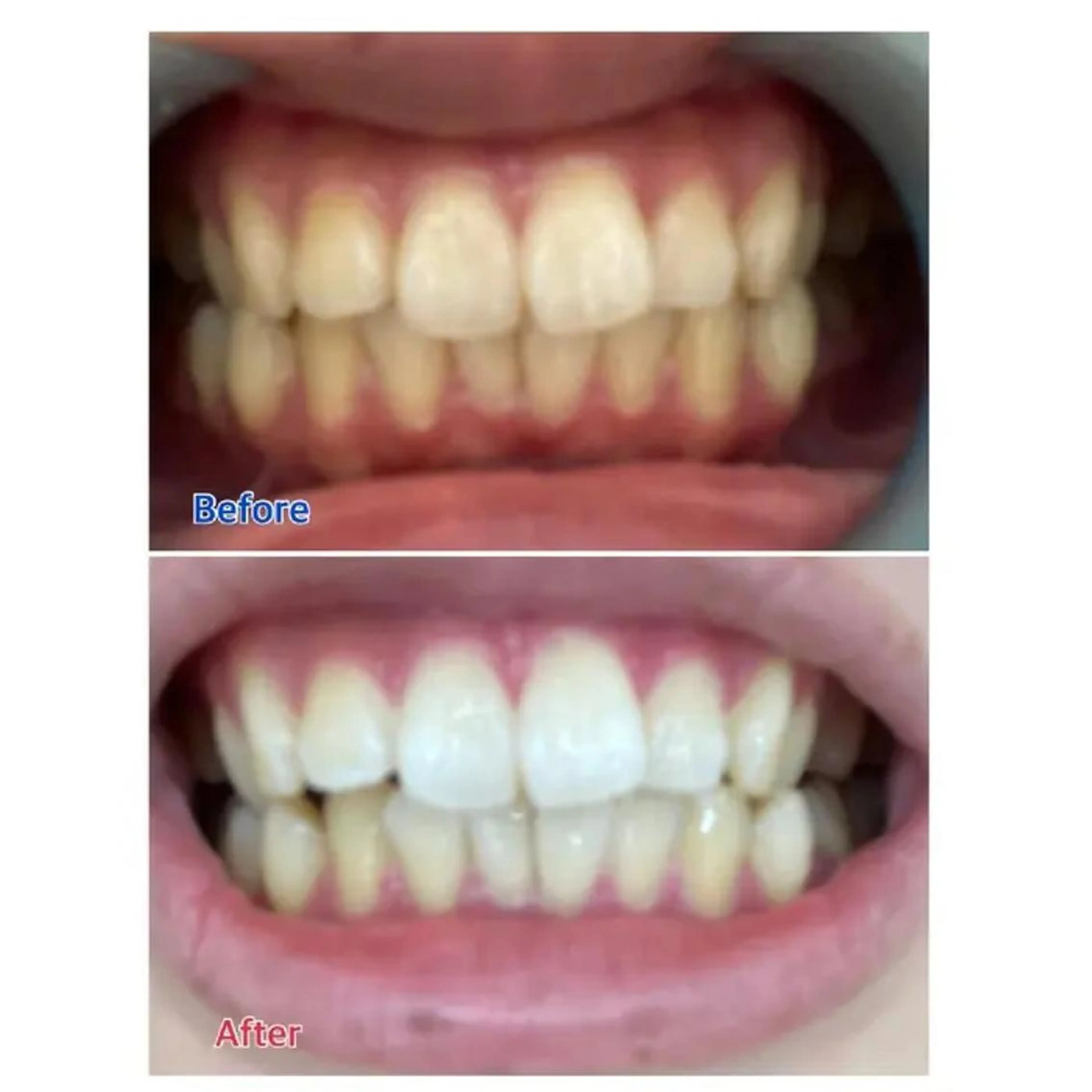 M渋谷 ホワイトニングのその他イメージ