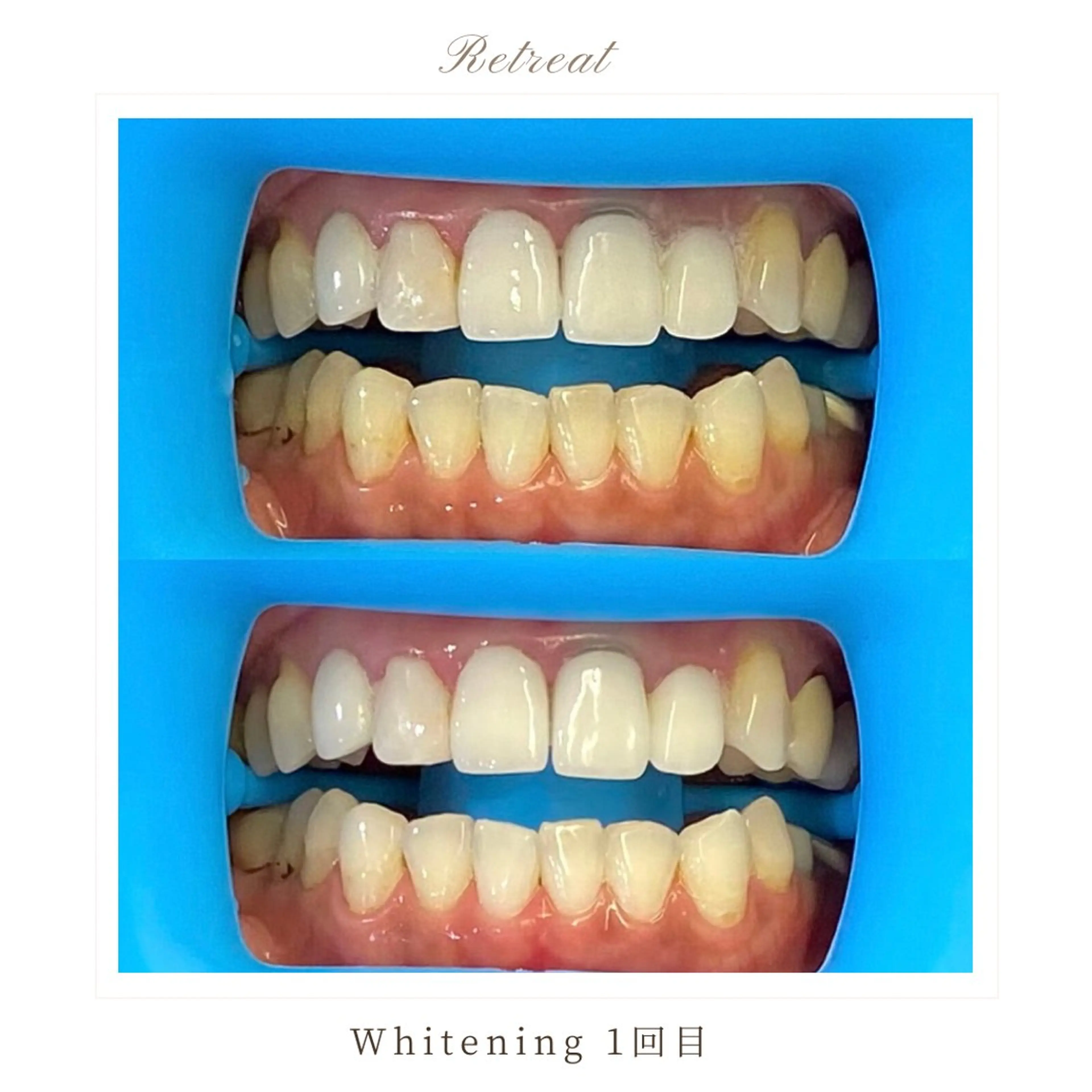 歯科医院提携 Retreatのエステ・リラクイメージ