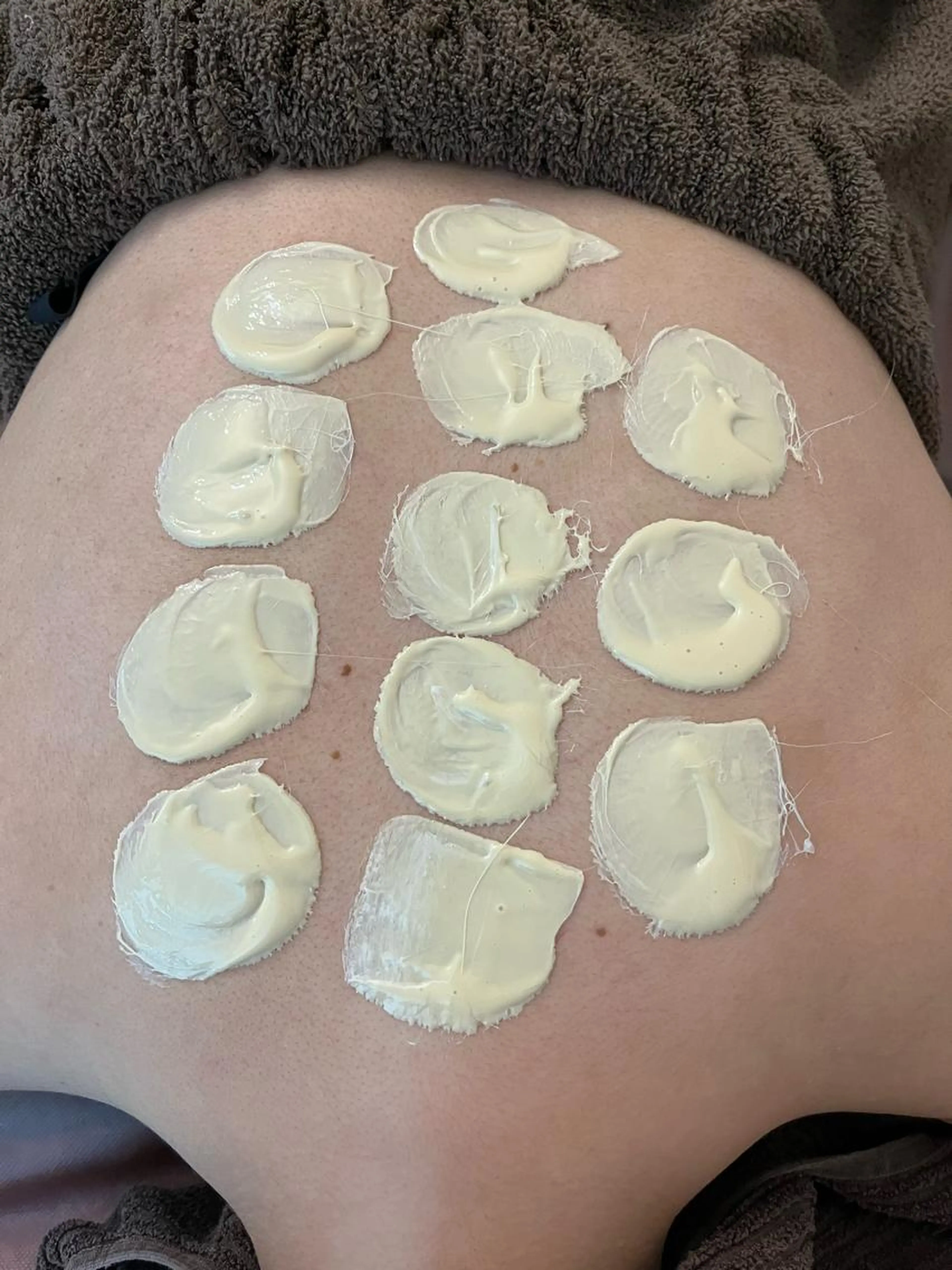 背中wax脱毛❣️角質もとれ背中の産毛をつるつるに✨アフターパック付きの写真