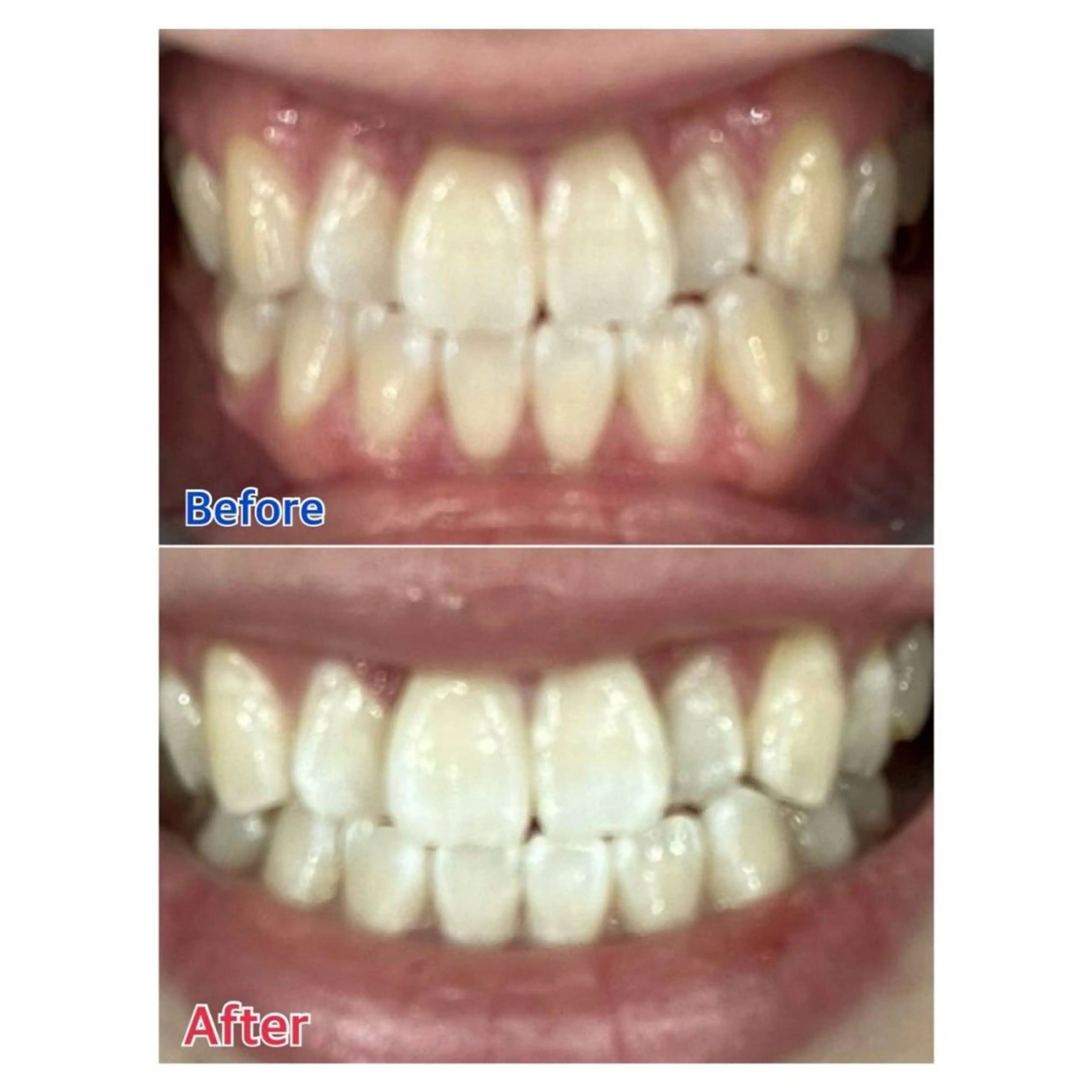 Melty 輝のその他イメージ