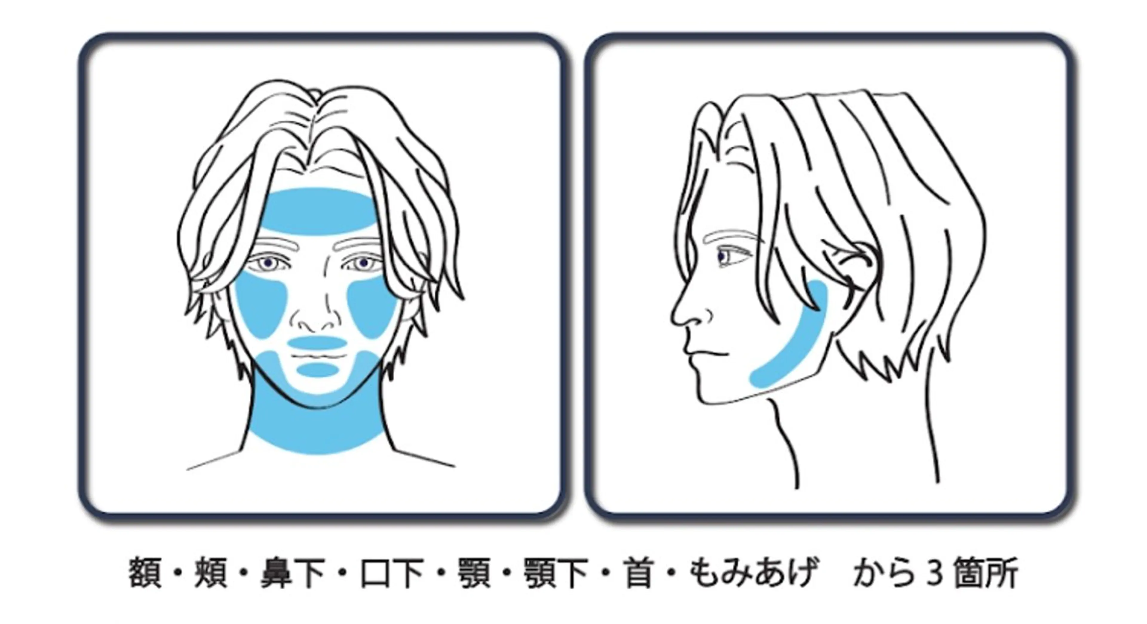 ヒゲ脱毛選べる3パーツの写真