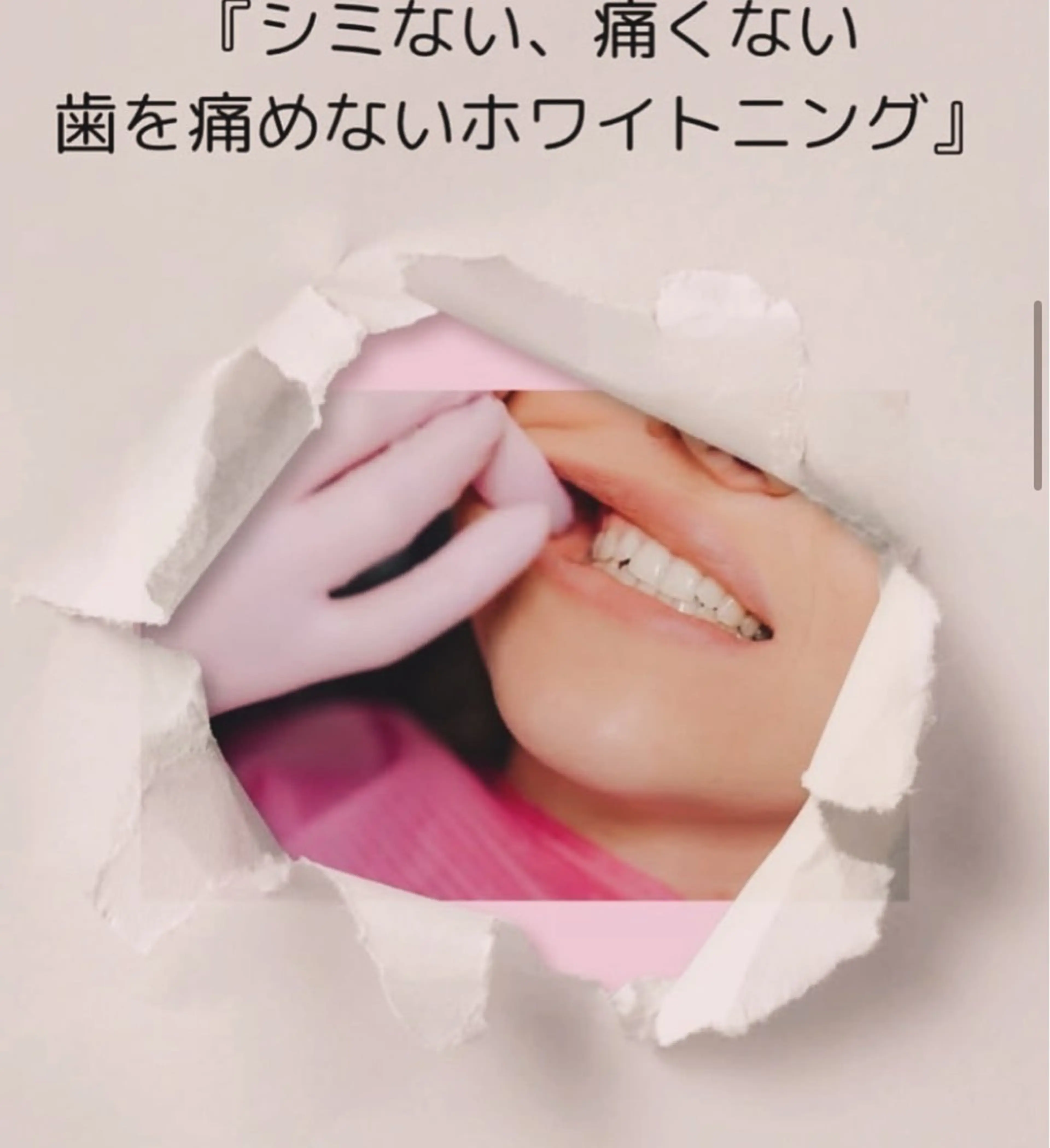 ホワイトニング ショップ伊丹店のその他イメージ