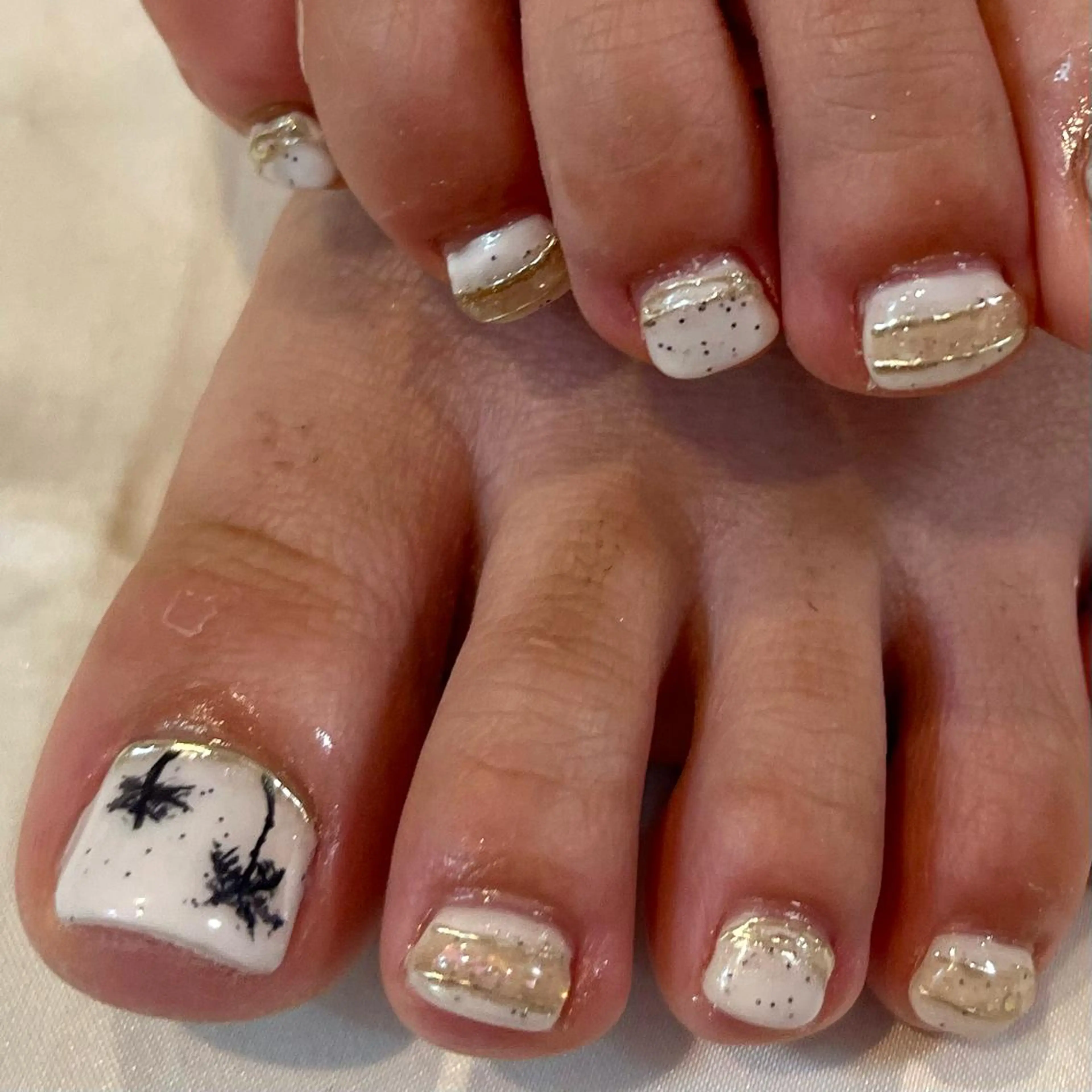 フット持ち込みデザイン（パラジェル）の写真