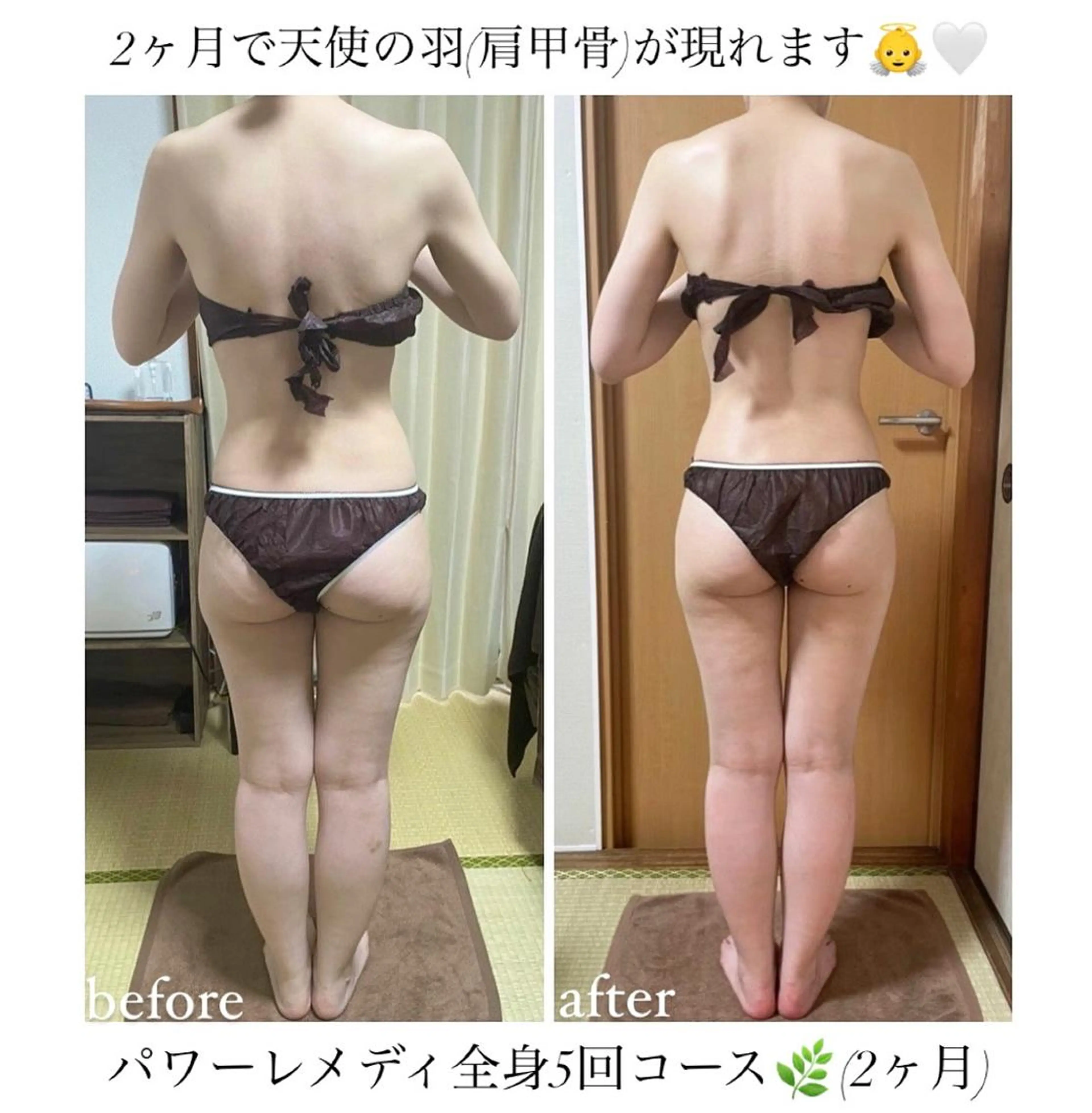 《本気痩せ×疲労改善 》  BILOOPのエステ・リラクイメージ