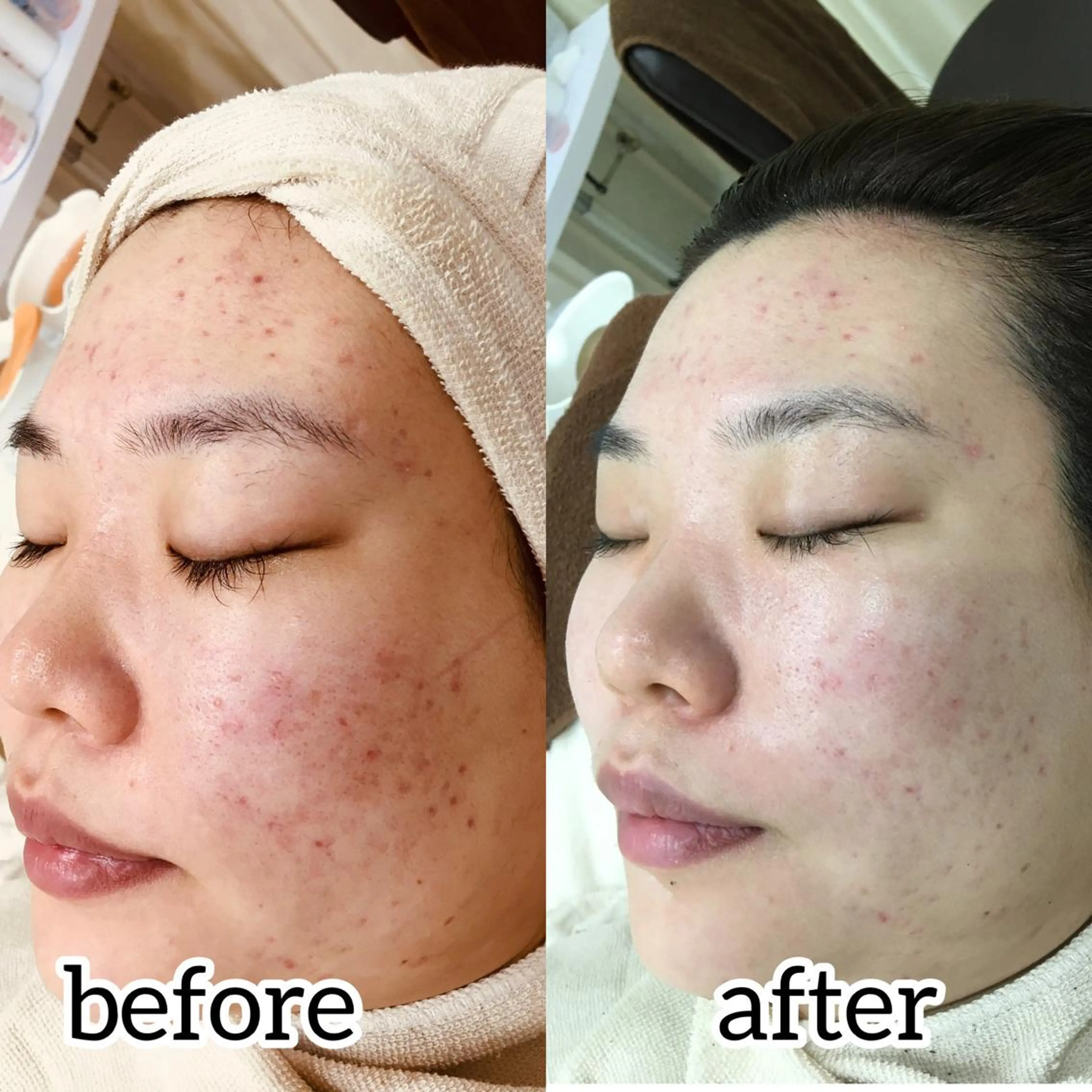 laluna saki...のその他イメージ