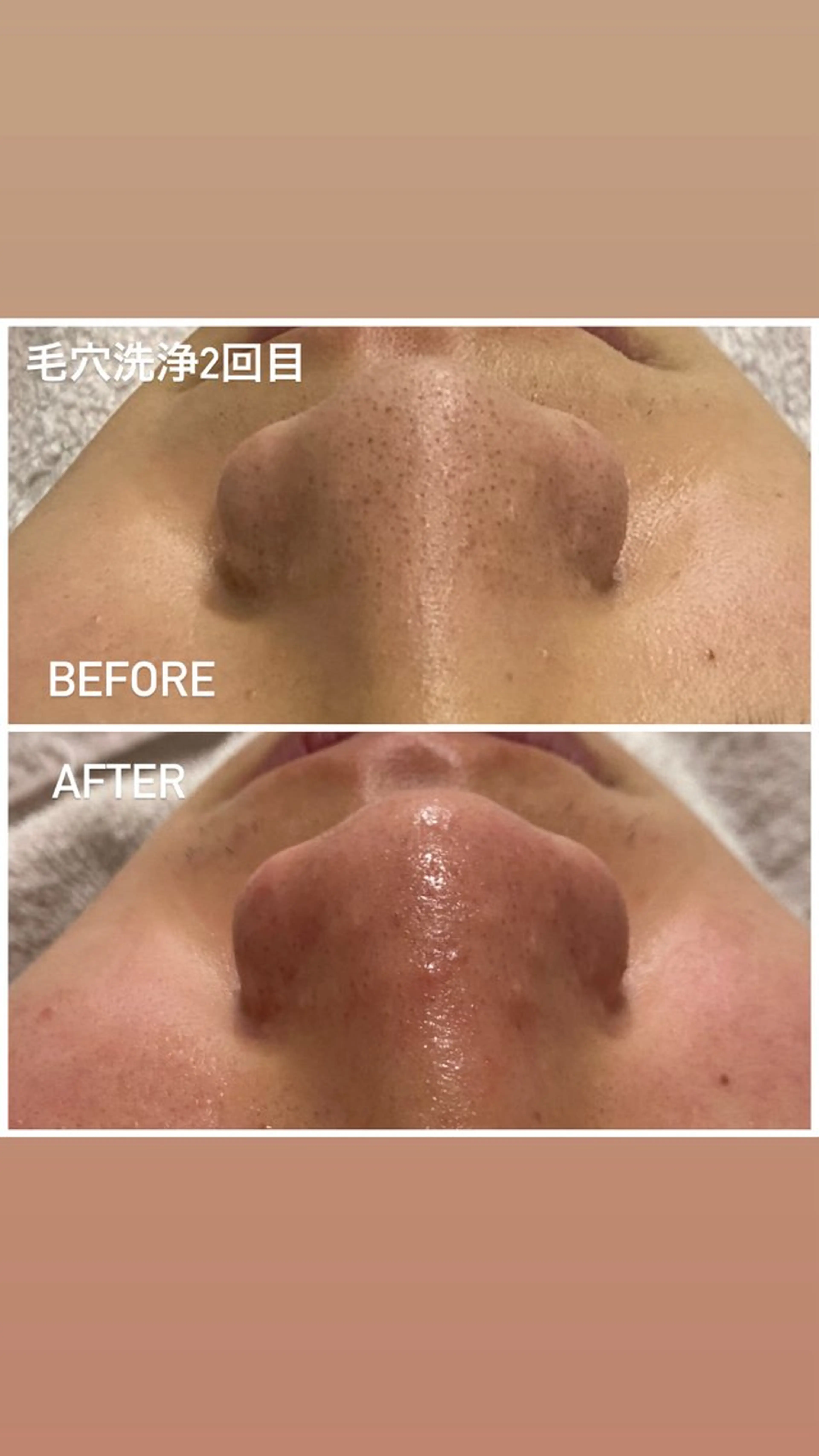 エステ 毛穴洗浄・痩身・脱毛 /アルカンジュのエステ・リラクイメージ