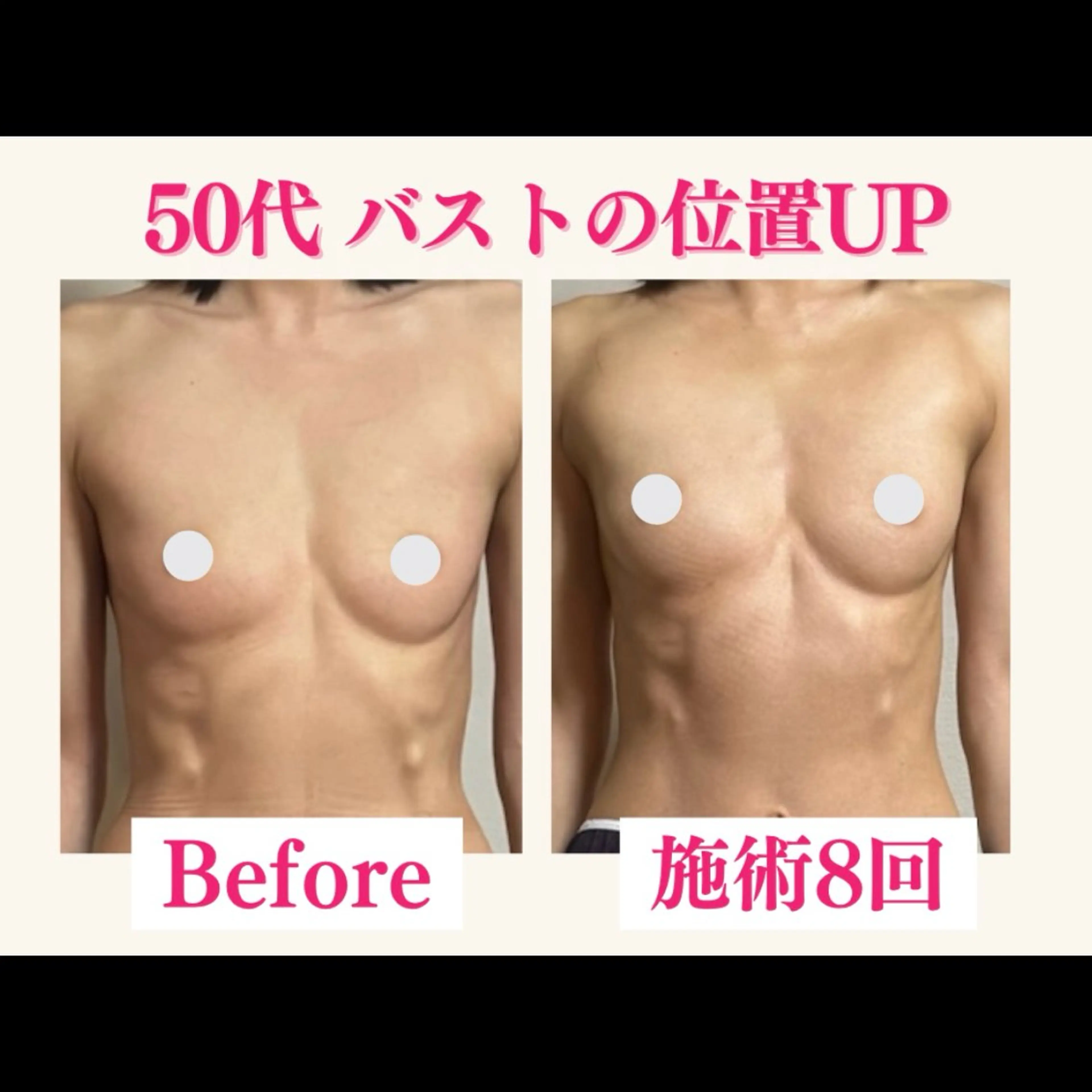 エステ リラク エクラパピヨン バストアップサロンのエステ・リラクイメージ