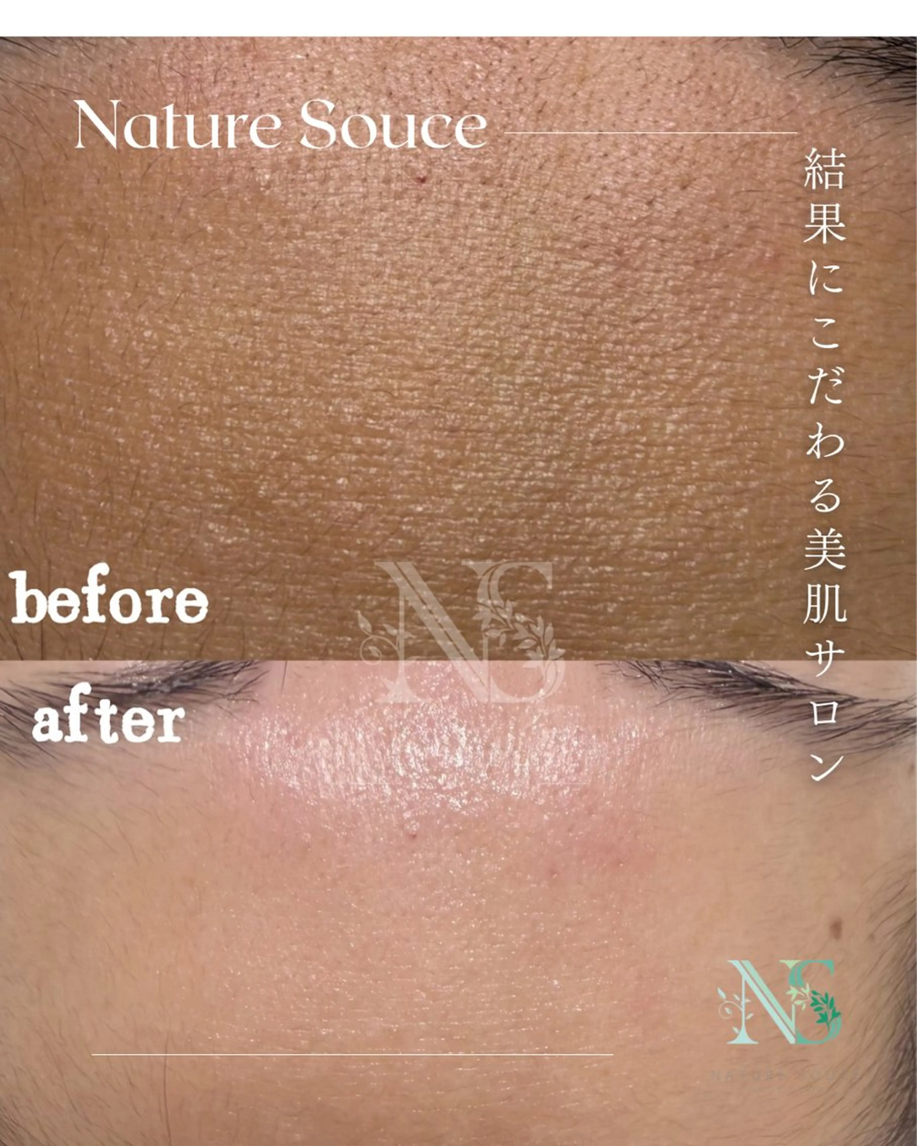 その他 Nature Souce毛穴専門店のその他イメージ