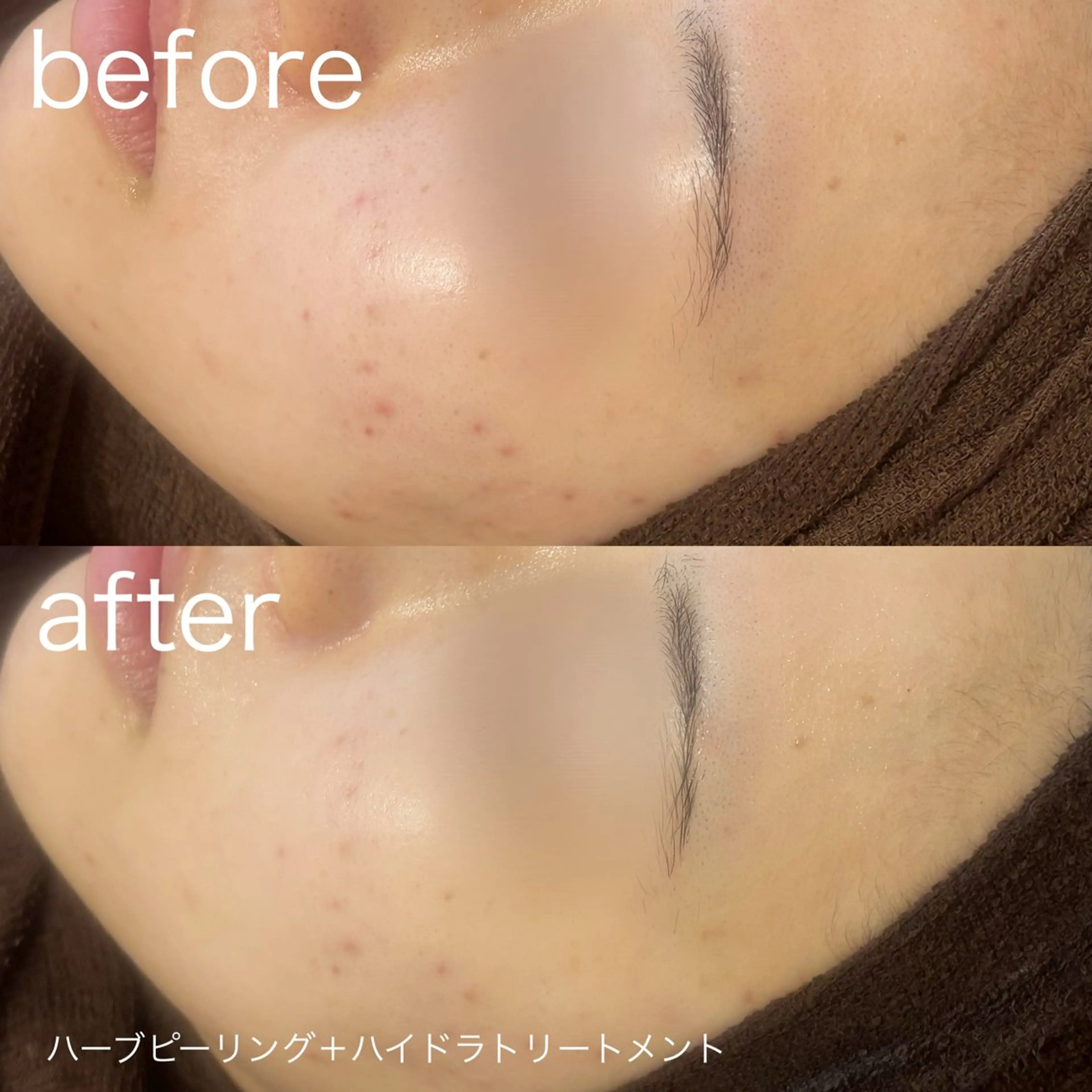 脱毛 lulularico Yuのエステ・リラクイメージ