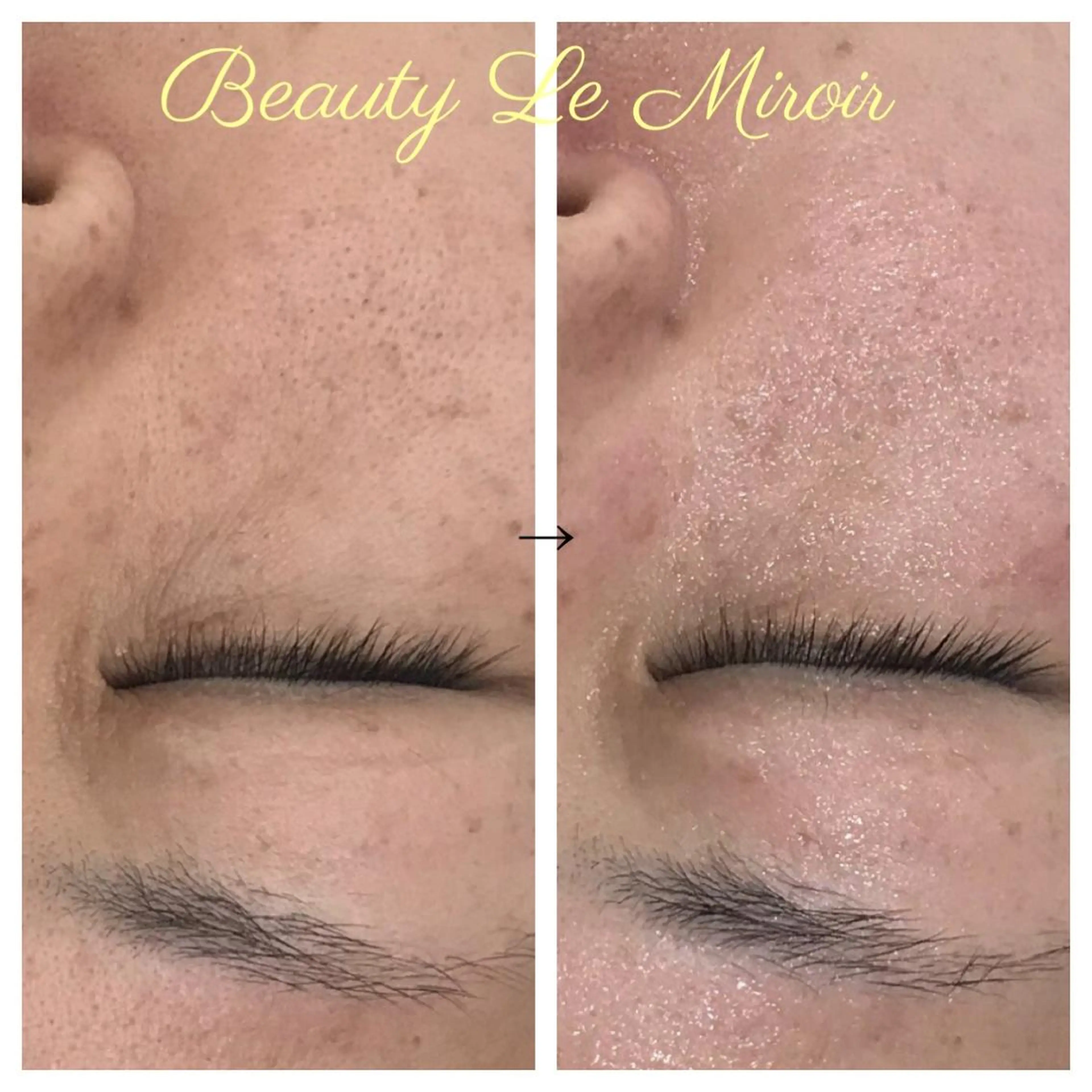 ビューティー ミロワールのエステ・リラクイメージ