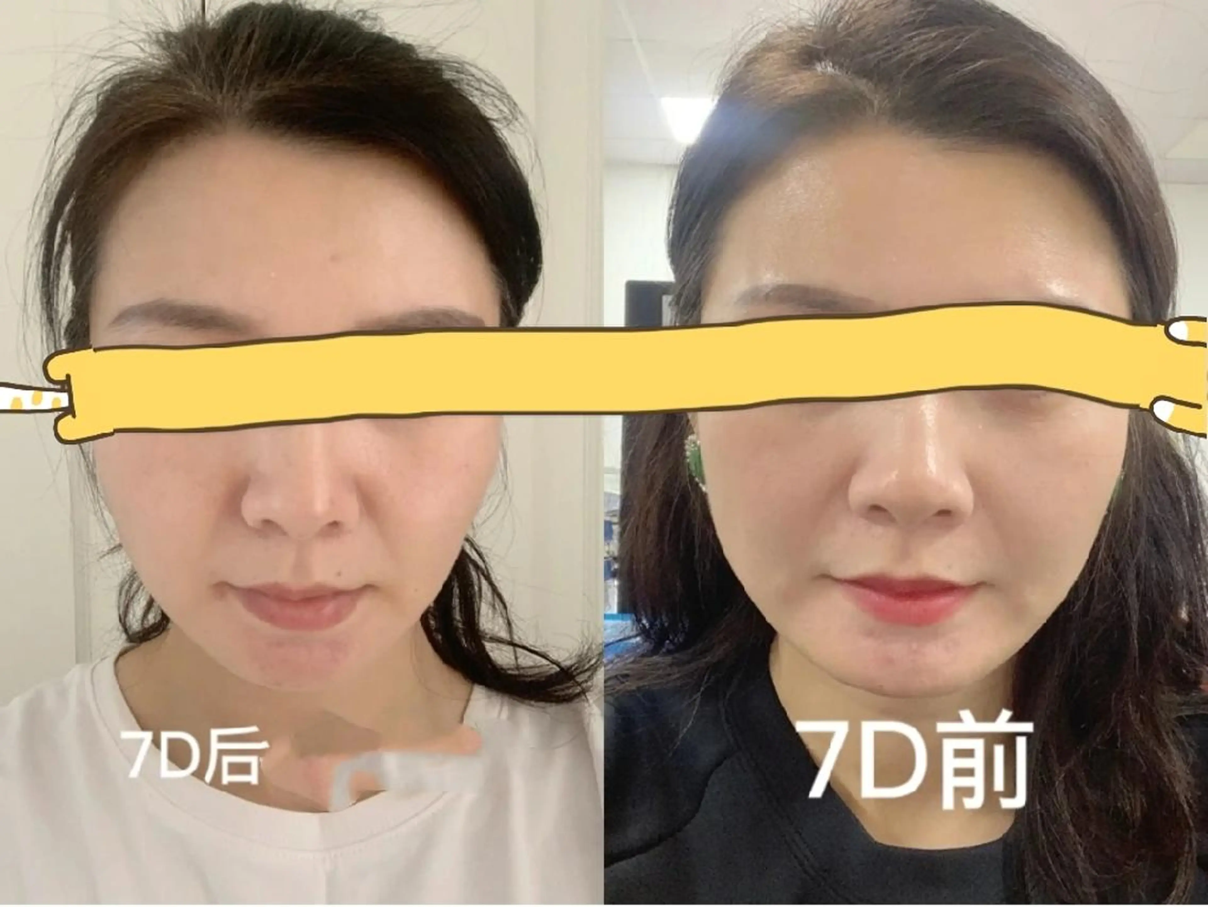 aliaハーブ水光店 エステティシャン募集のエステ・リラクイメージ