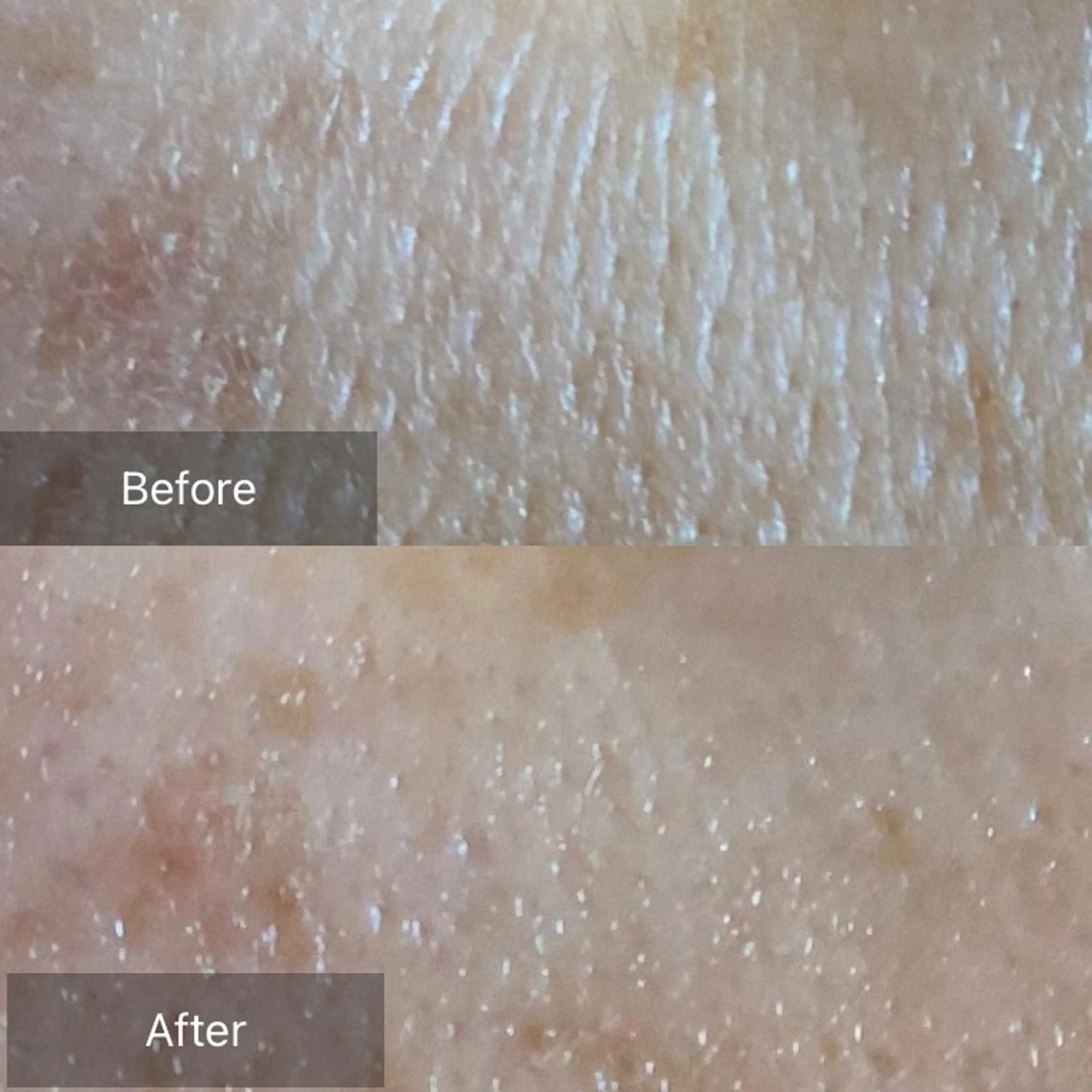 毛穴から始める肌メン テマンダリンオレンジのエステ・リラクイメージ