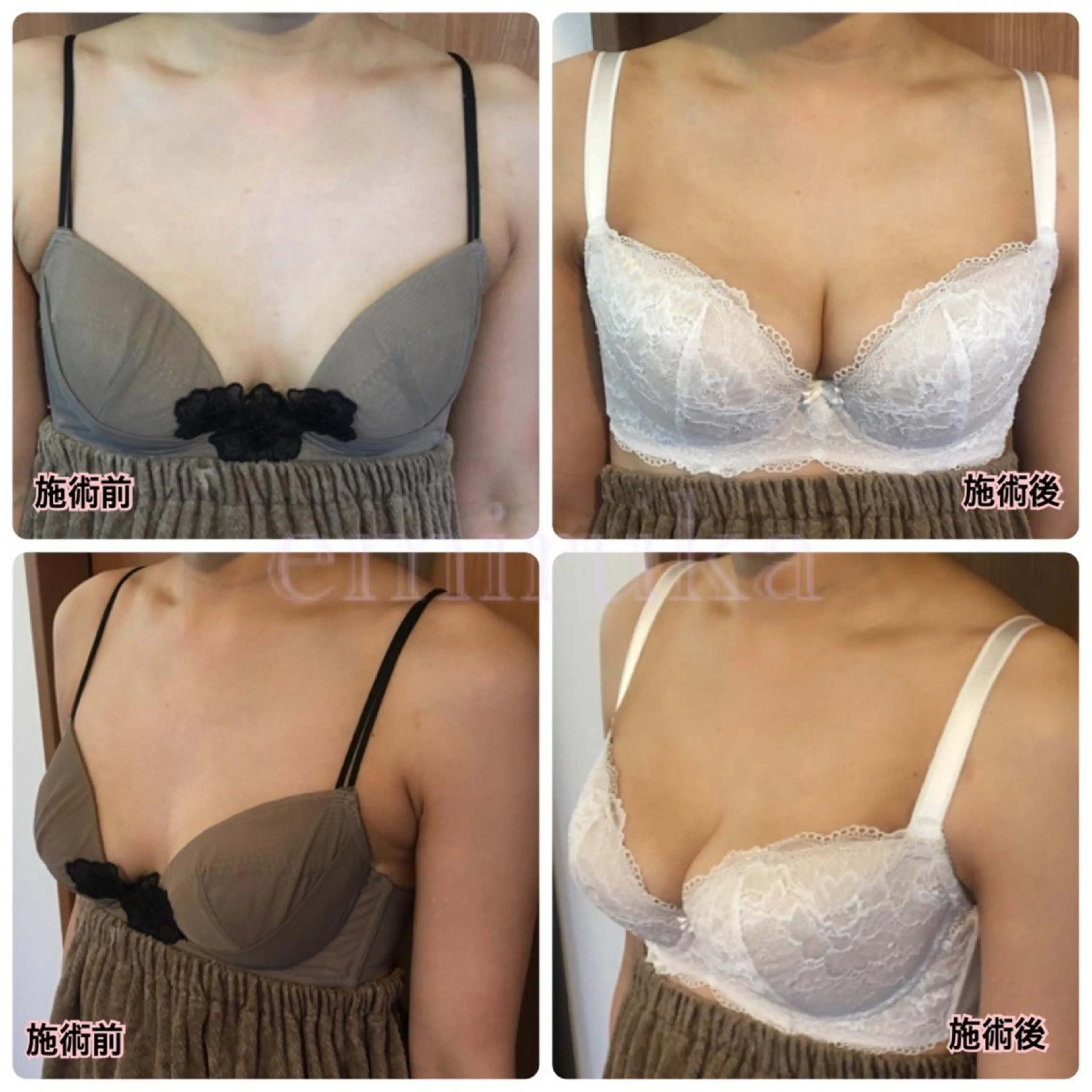 バストアップサロン エミルカのその他イメージ