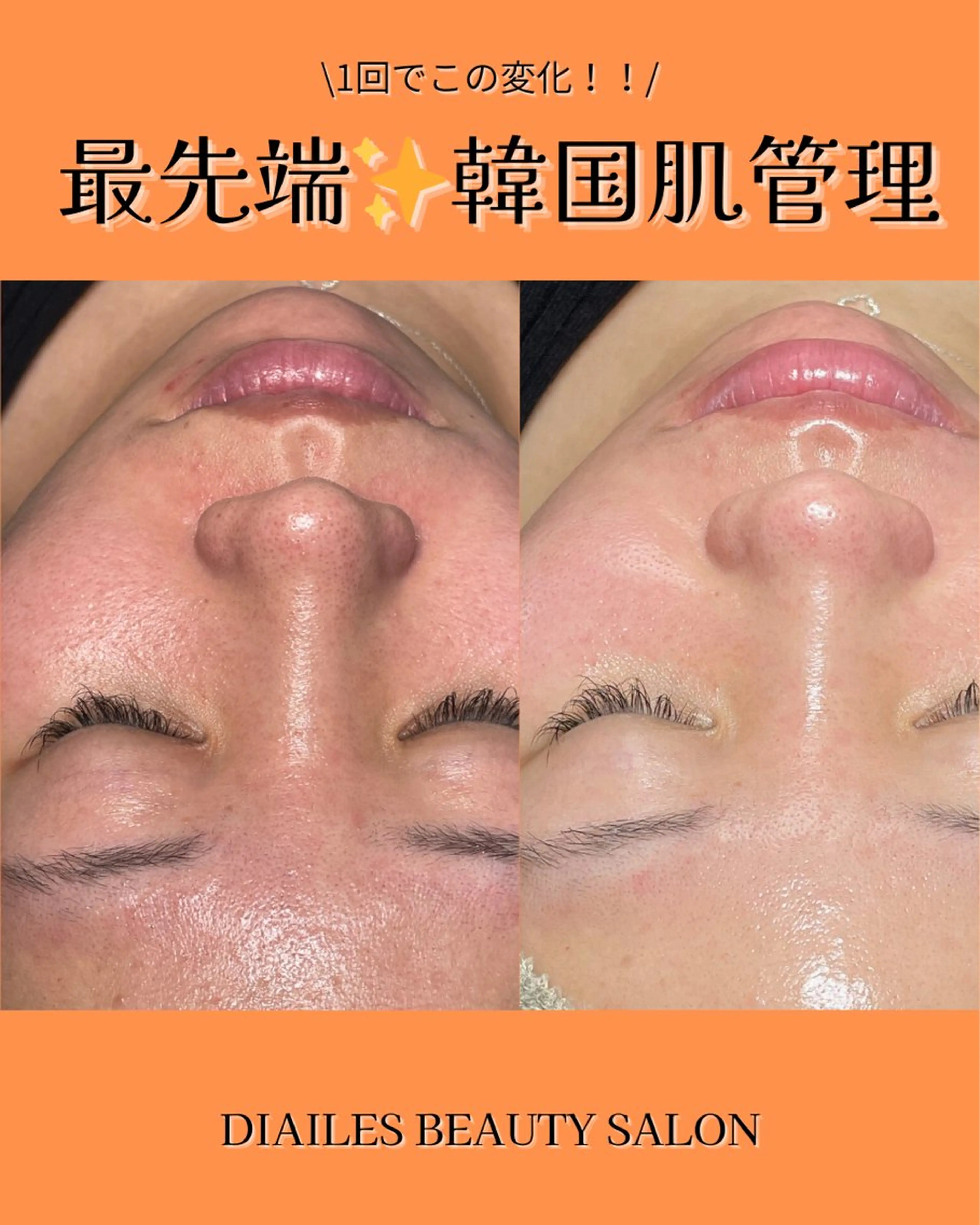 エステ Diailes 💎ななのエステ・リラクイメージ