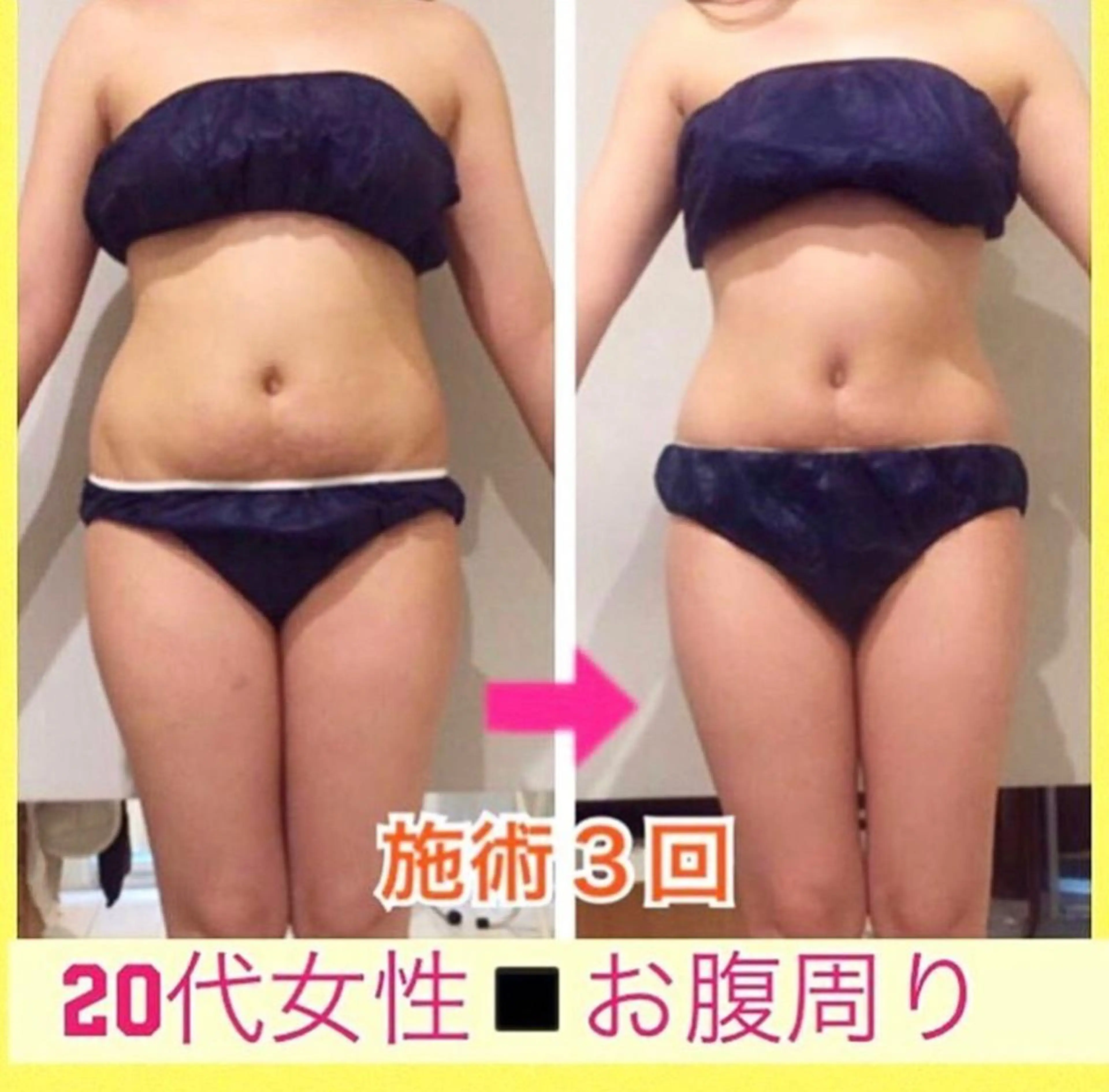 ショート カラー パーマ ヘアアレンジ メンズ キッズ ネイル マツエク・マツパ 痩身&ボディ 結果出し🌟丹野のエステ・リラクイメージ