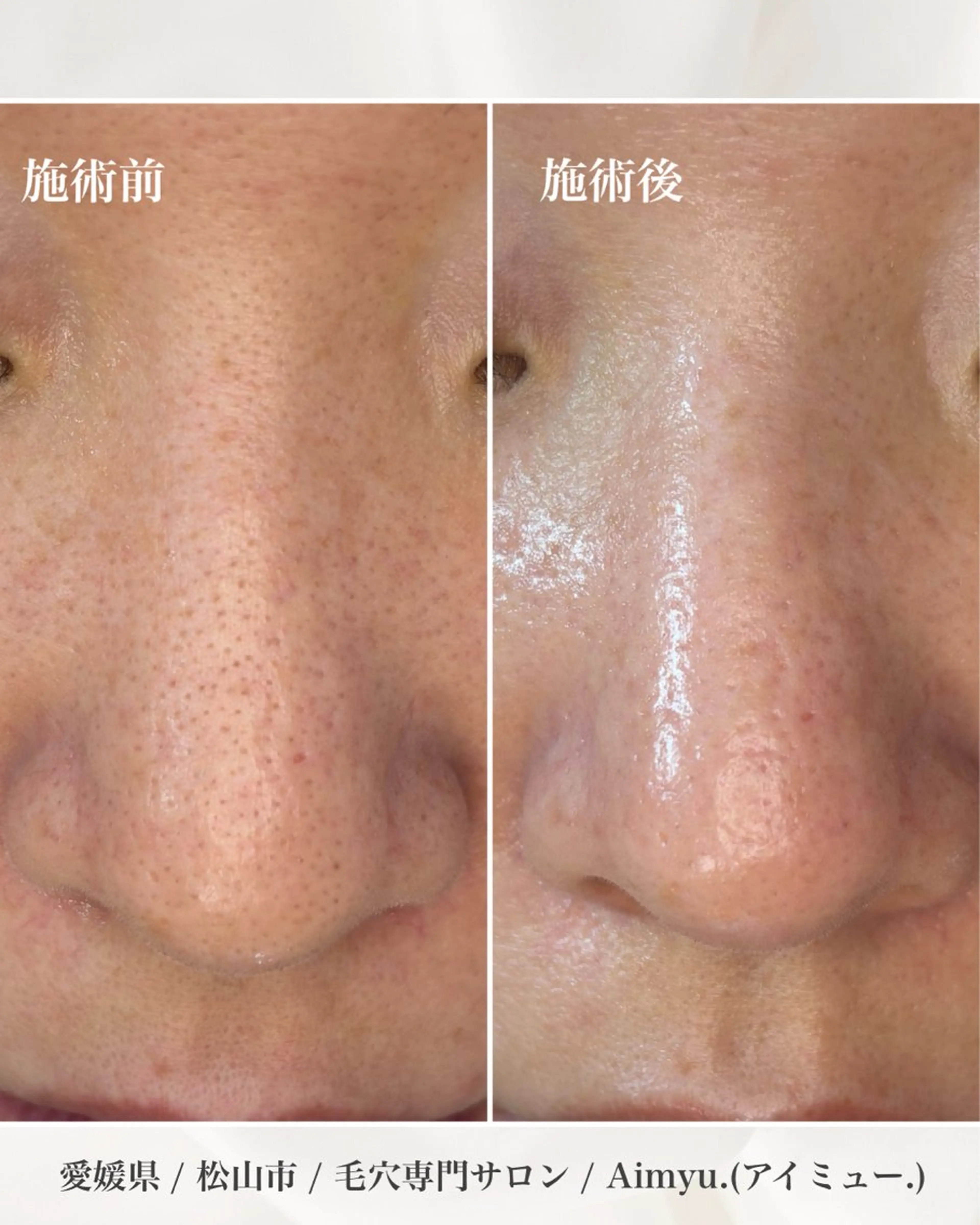 毛穴専門店アイミュー mamiのエステ・リラクイメージ
