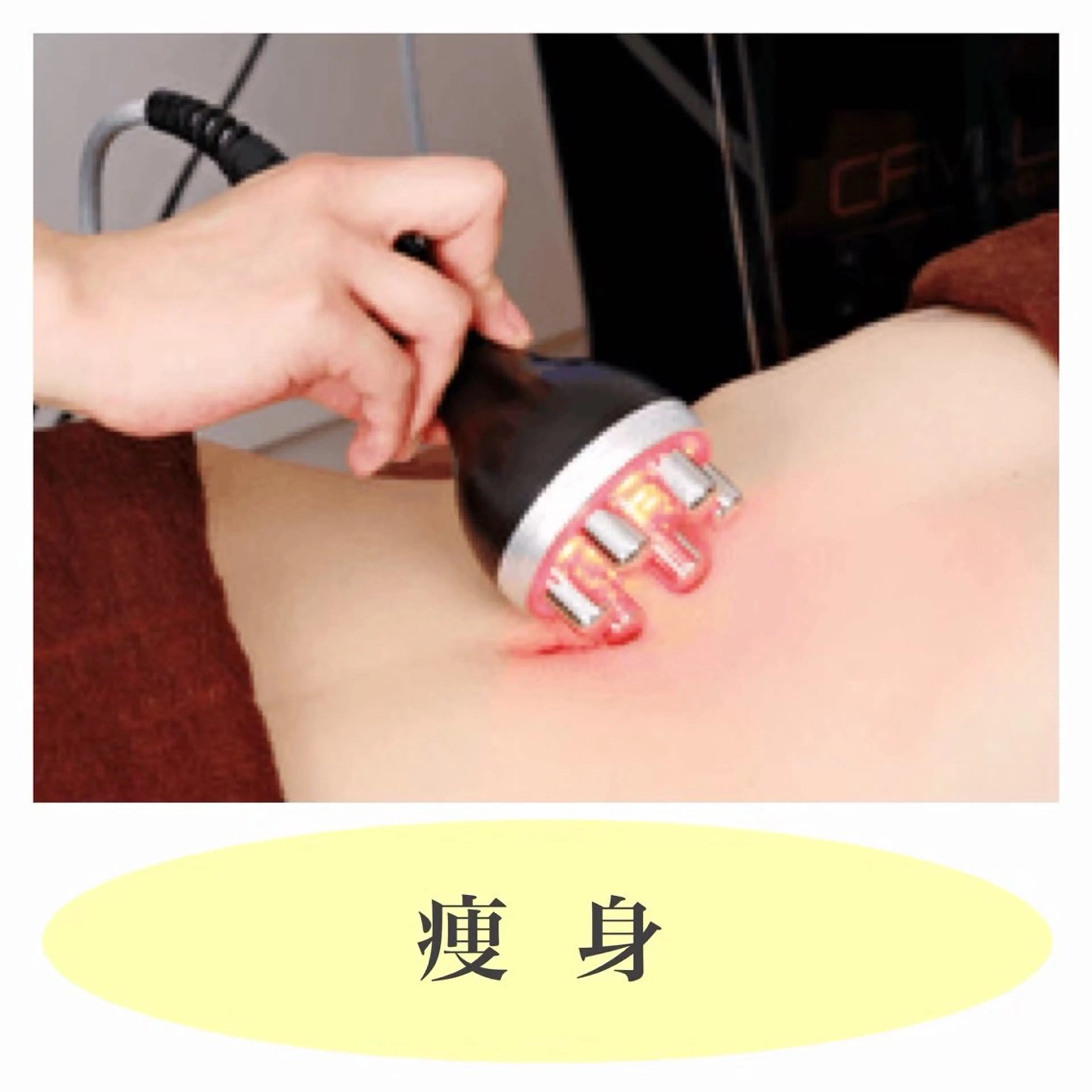 【半身スリム】上or下半身（キャビテーション/ラジオ波/吸引/EMS） 結果重視最強マシンの写真