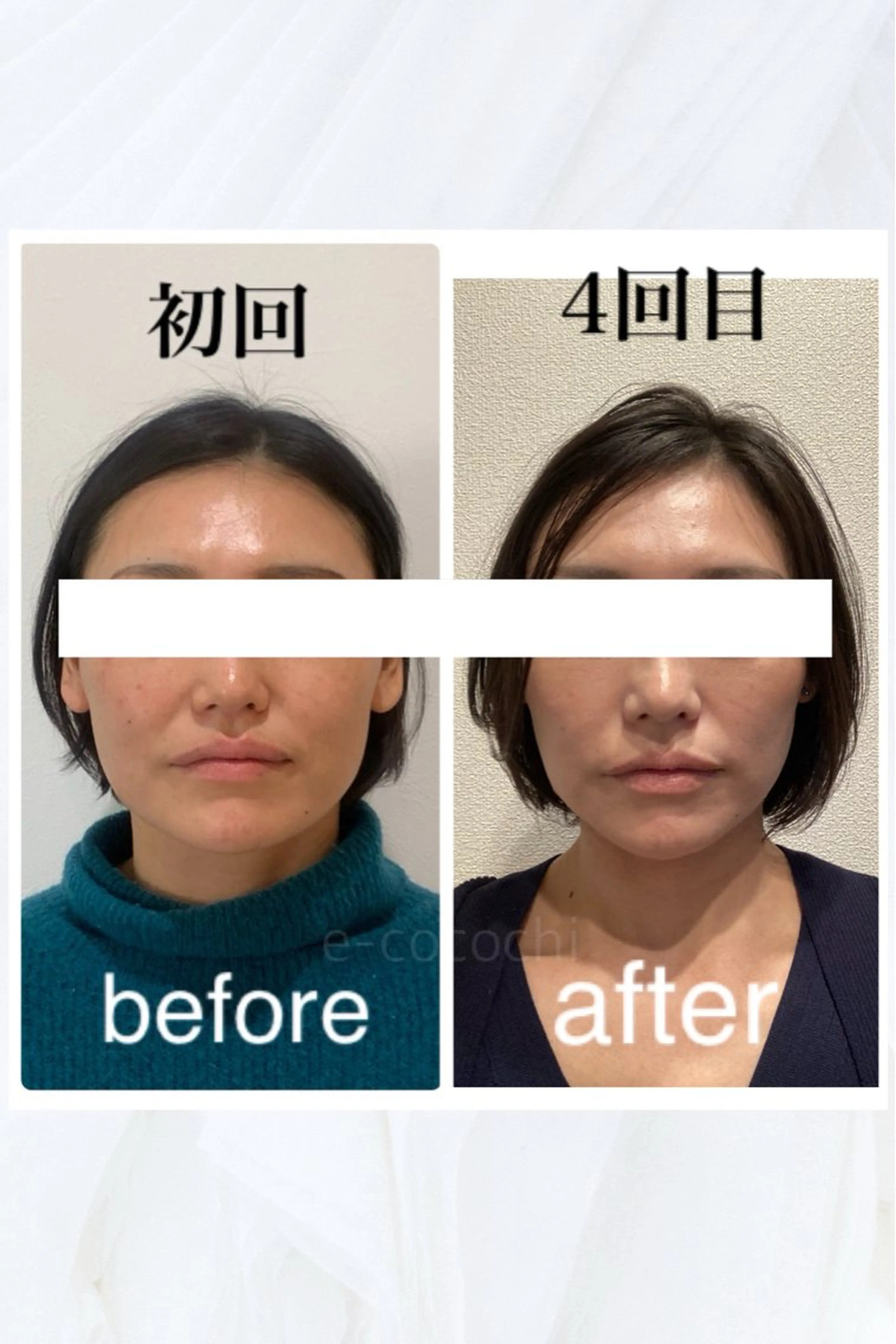 エステ リラク 小顔と ヘッドスパのお店のエステ・リラクイメージ