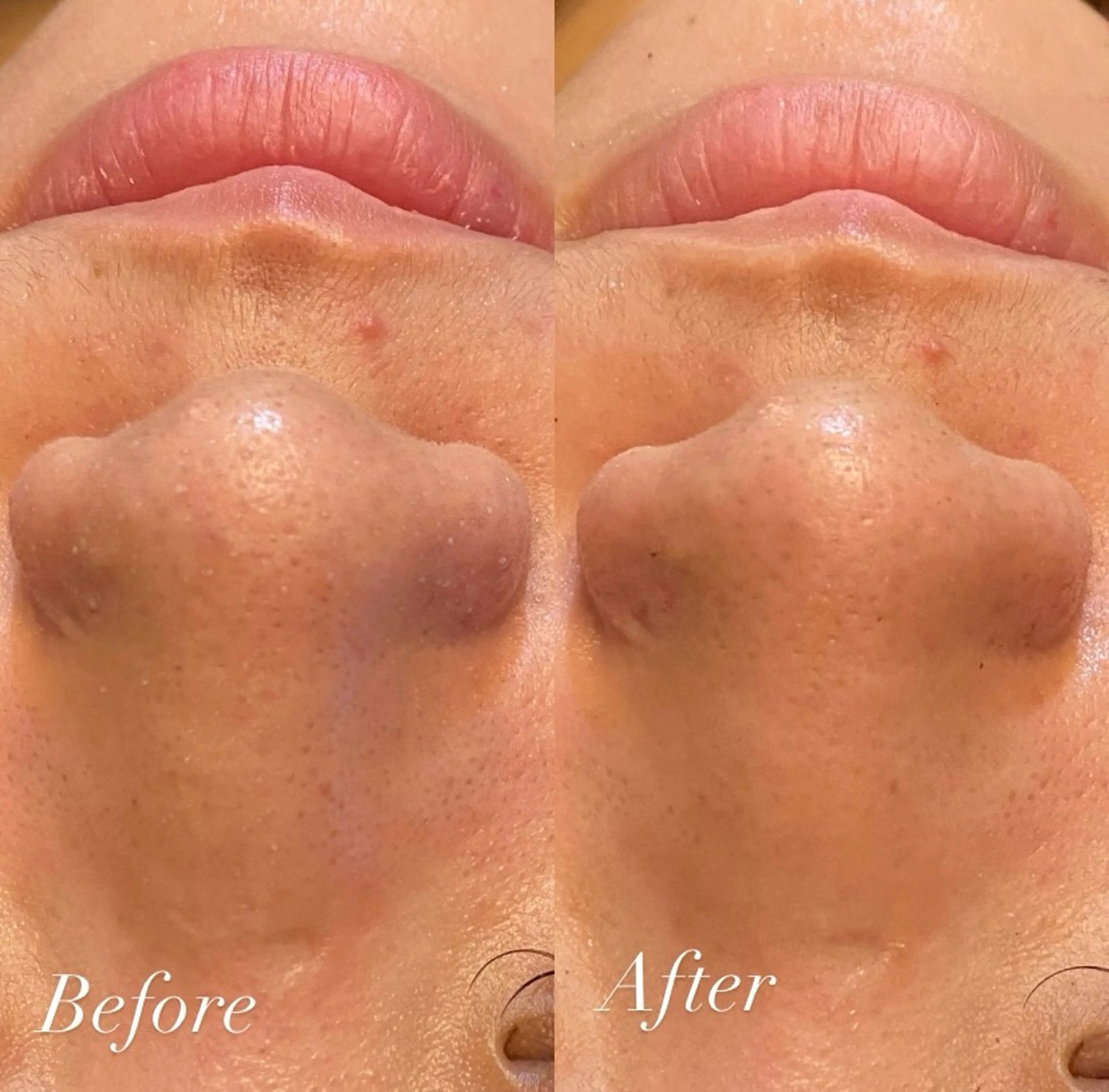 エステ 肌質改善専門 ハーブ /毛穴洗浄 リエイトのエステ・リラクイメージ