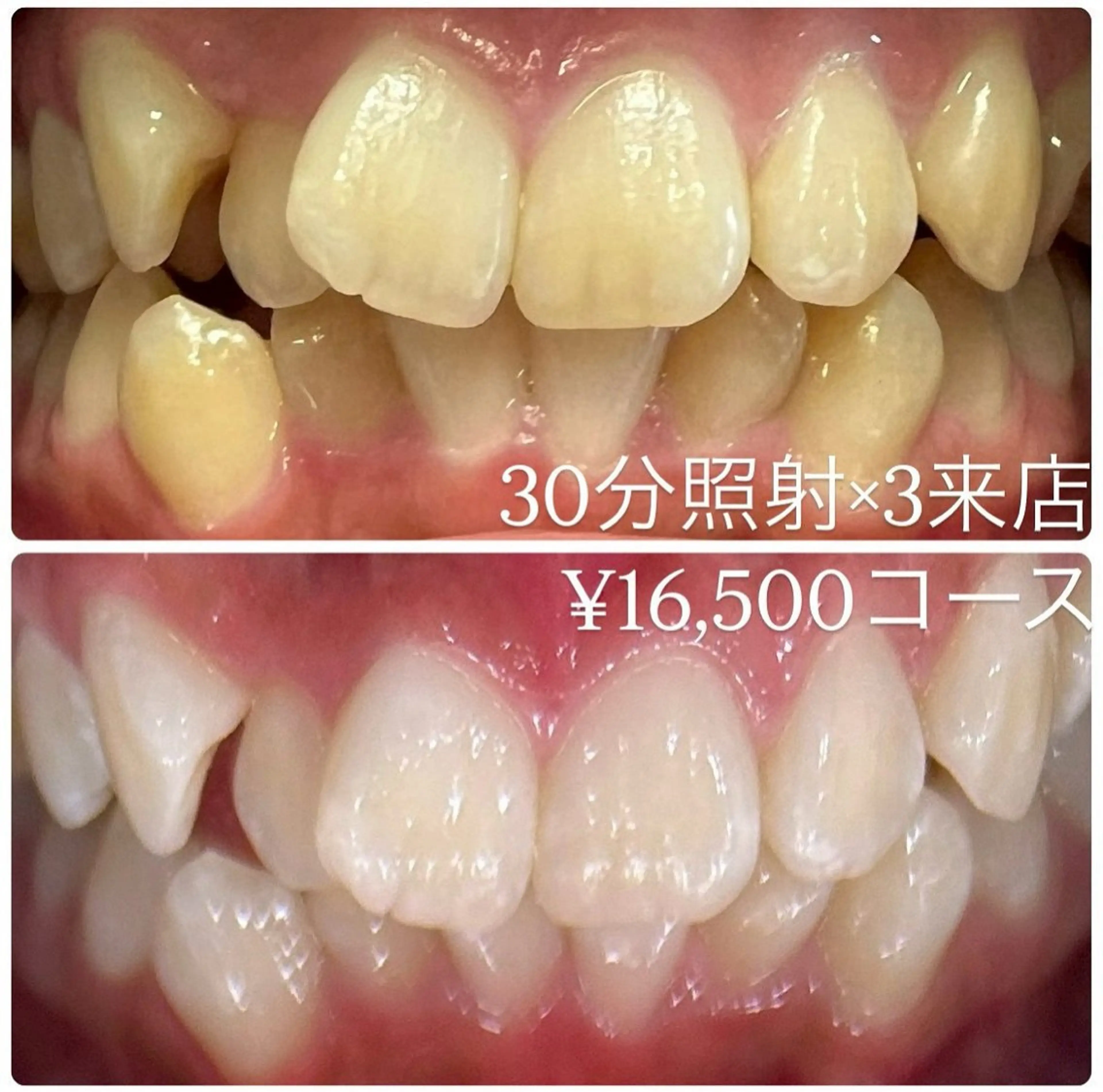 その他 ホワイトニングルーム 横浜店のその他イメージ