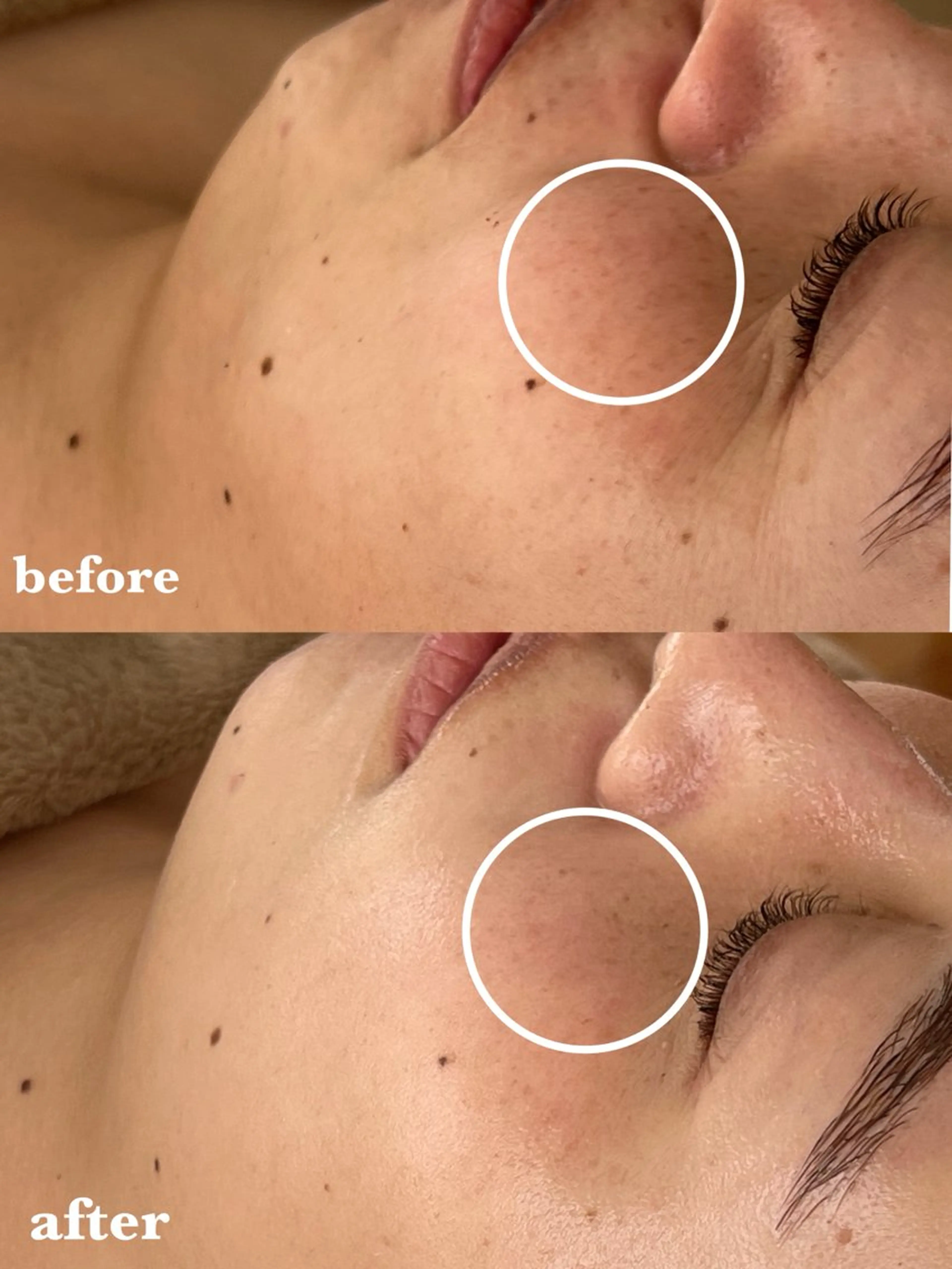 エステ 河合 菜月のエステ・リラクイメージ