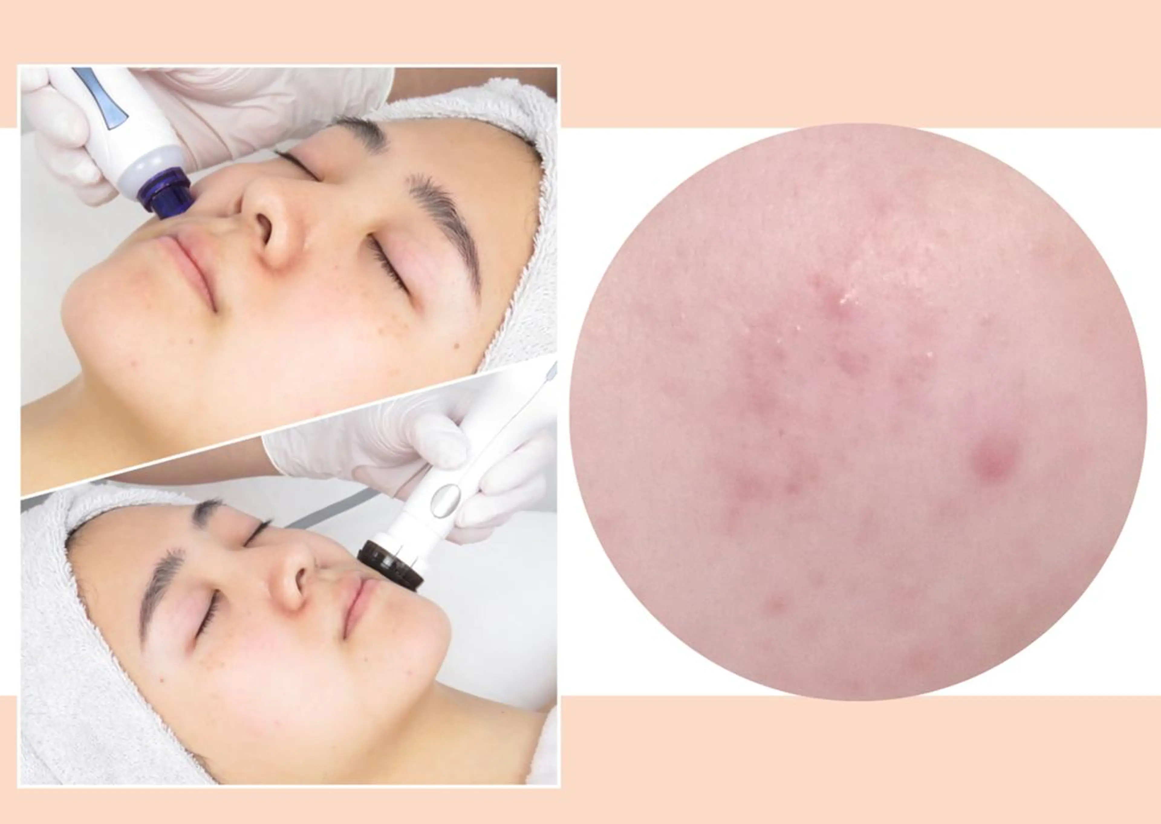 CLEAD 赤坂見附店のエステ・リラクイメージ