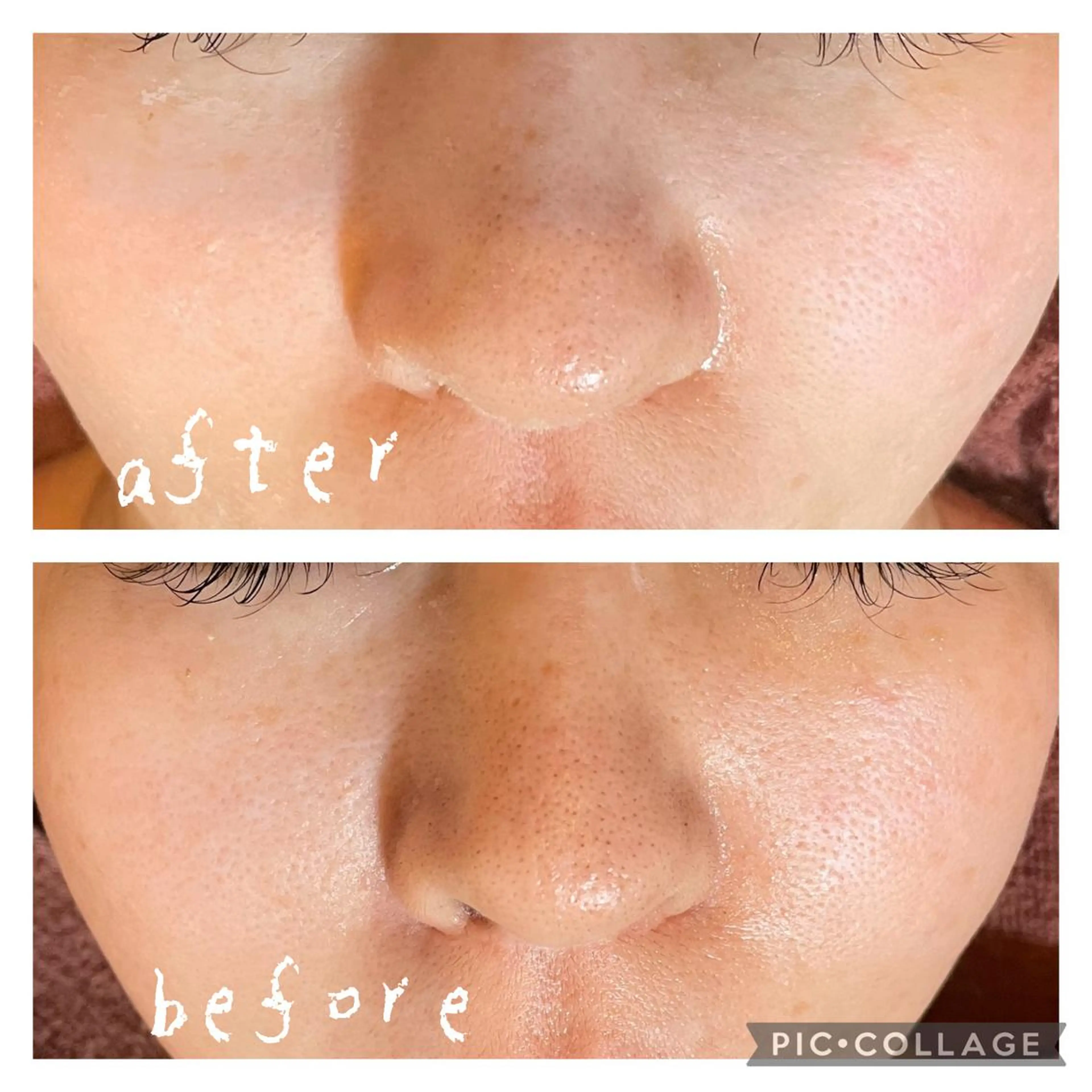 セミロング カラー パーマ ヘアアレンジ メンズ キッズ ネイル マツエク・マツパ アイブロウ ニキビ特化型エステ 🍋最短で肌質改善のエステ・リラクイメージ