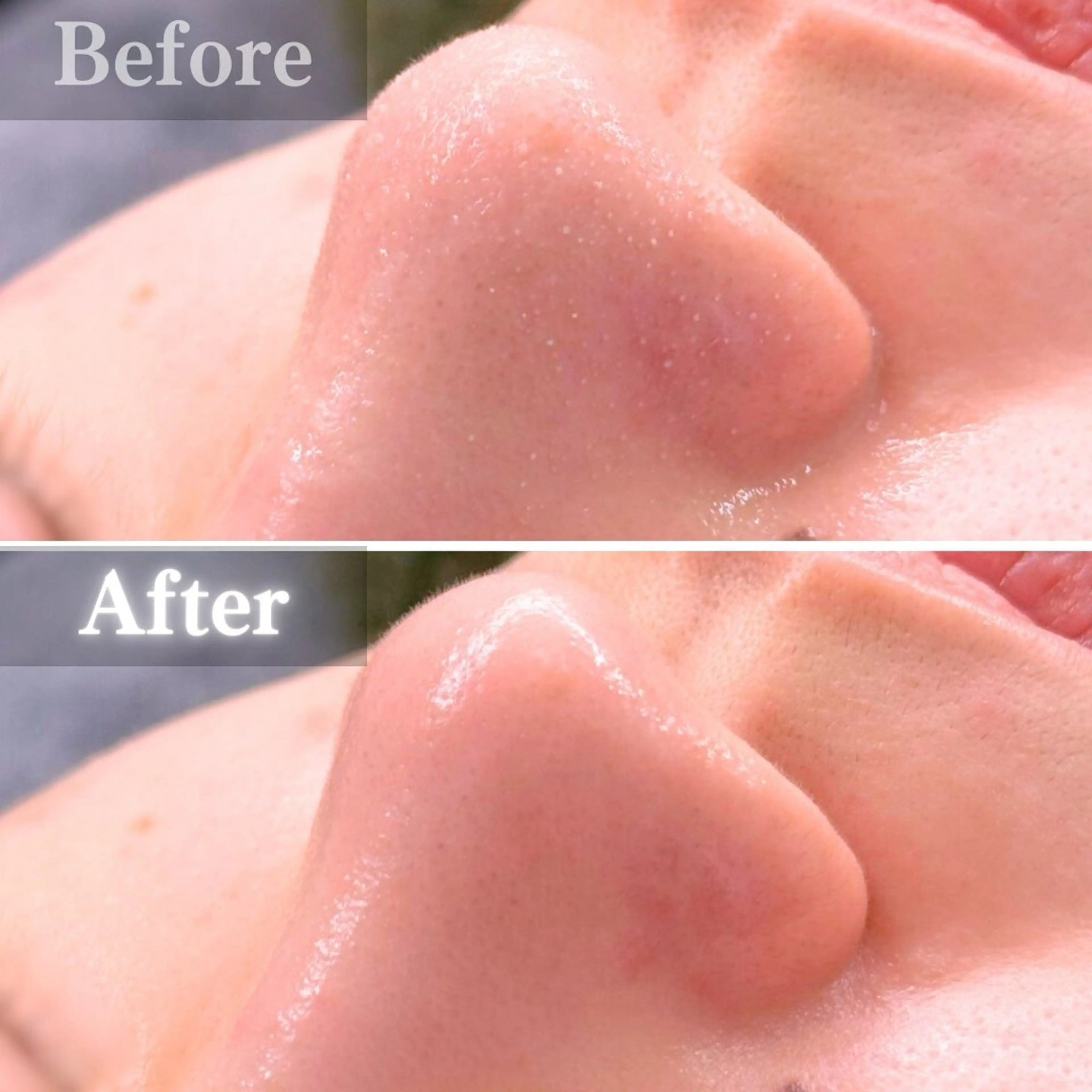 エステ 毛穴洗浄特化🫧 オオツカのエステ・リラクイメージ