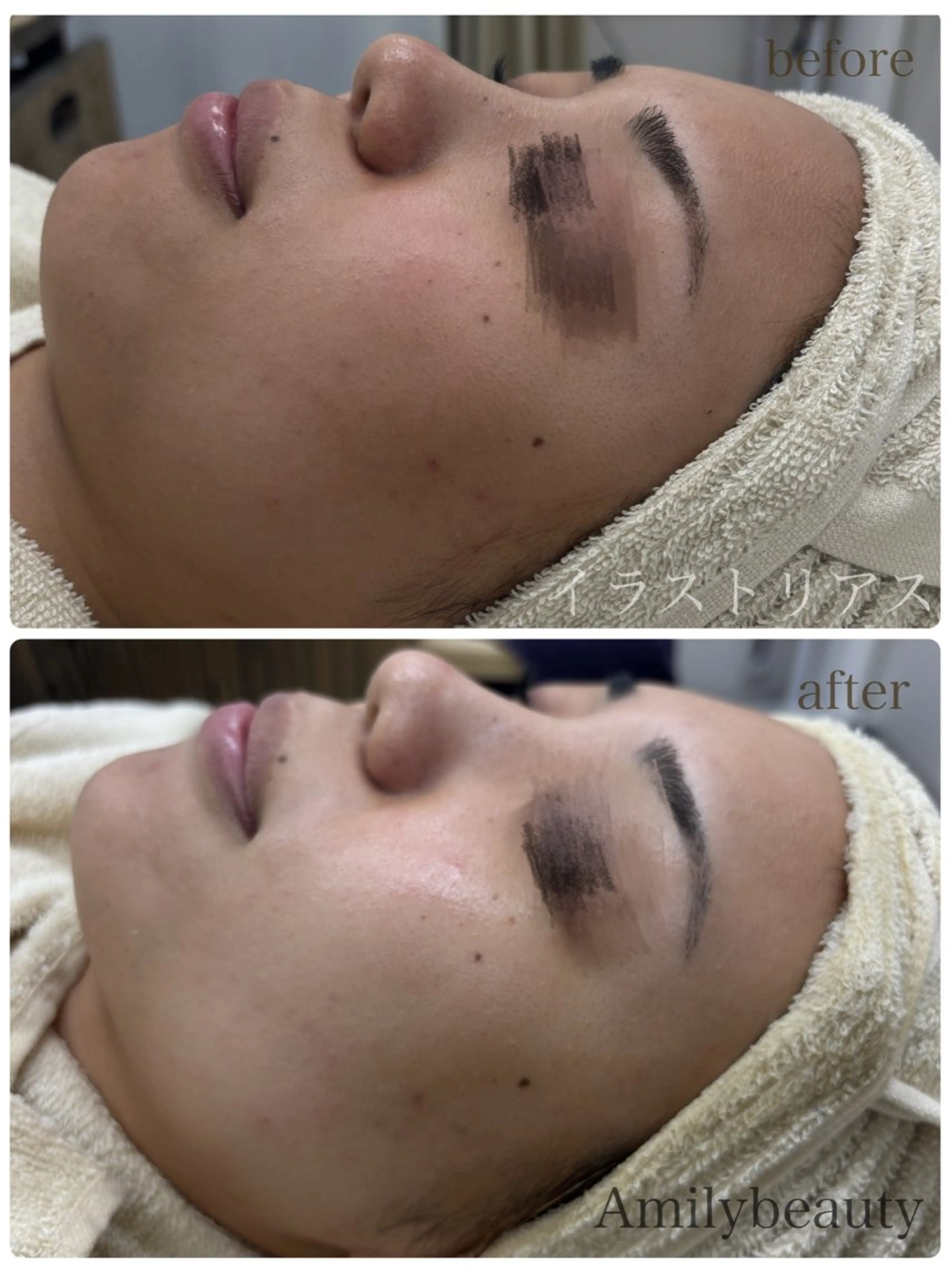 エステ Amily beauty 毛利のエステ・リラクイメージ