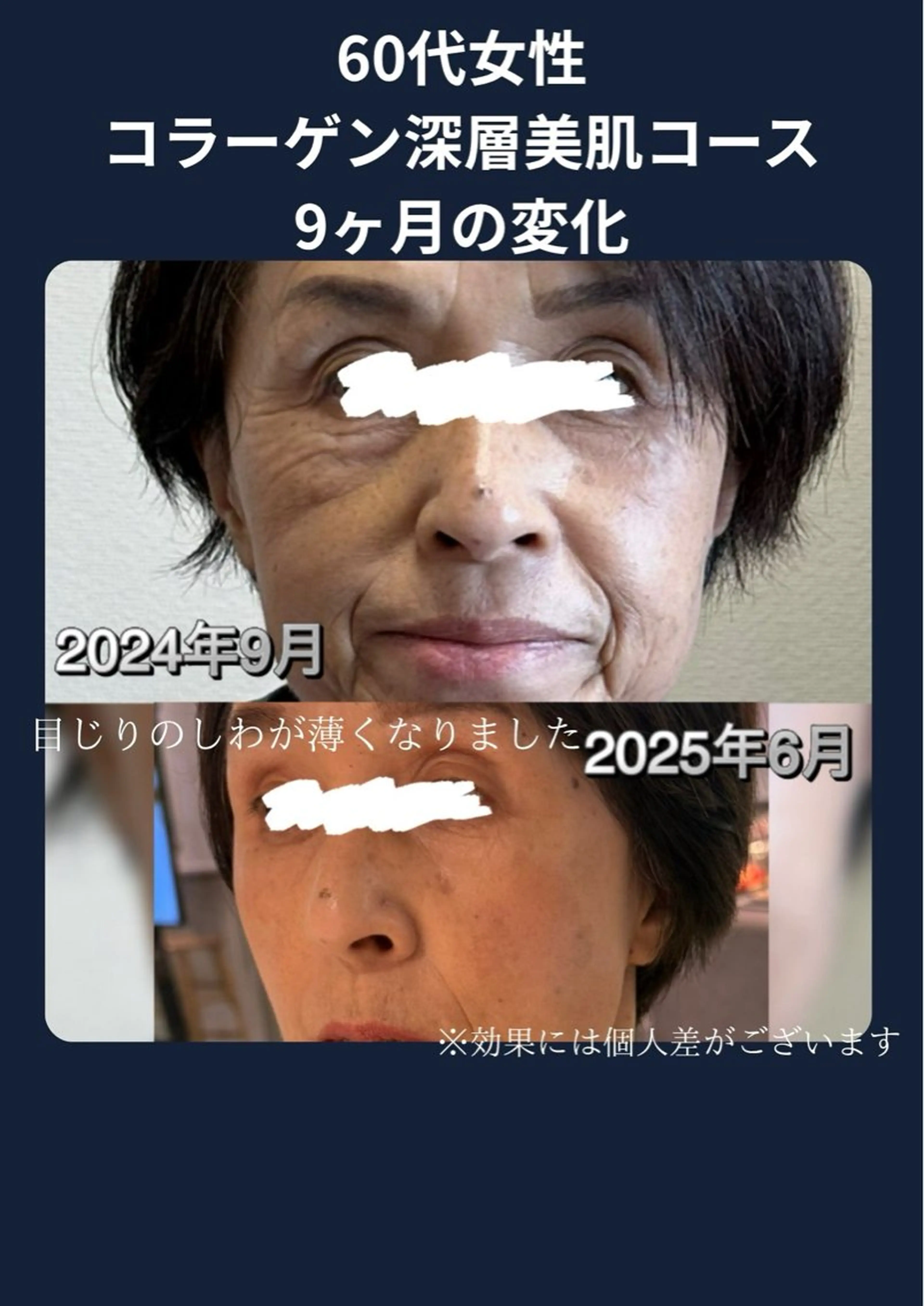 エステ 谷九上本町REINE YUKIのエステ・リラクイメージ