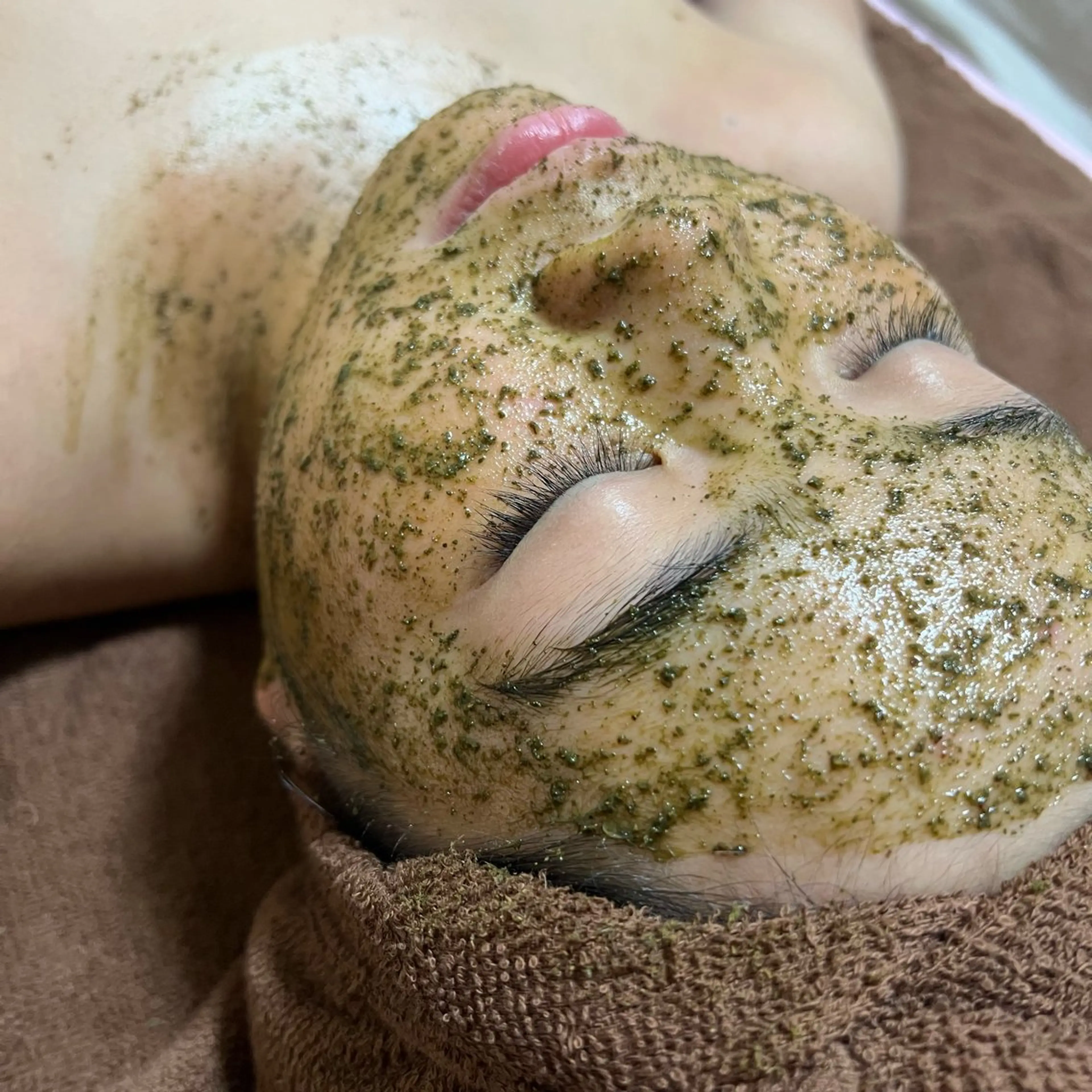 👭【キッズ】REVIハーブピーリング《陶肌トリートメント》 / 中学生​〜​18歳未満の方の肌荒れ改善！の写真