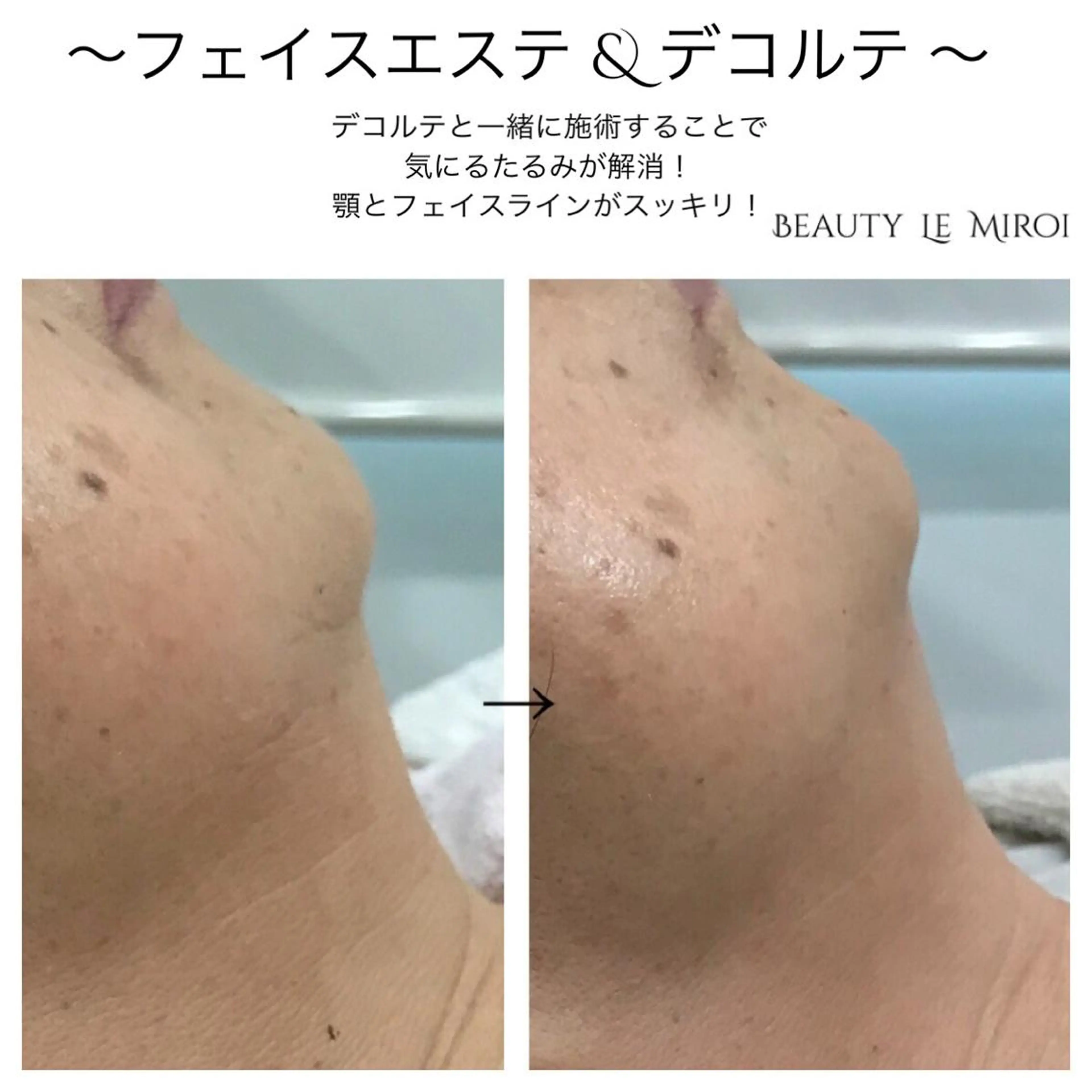 ビューティー ミロワールのエステ・リラクイメージ