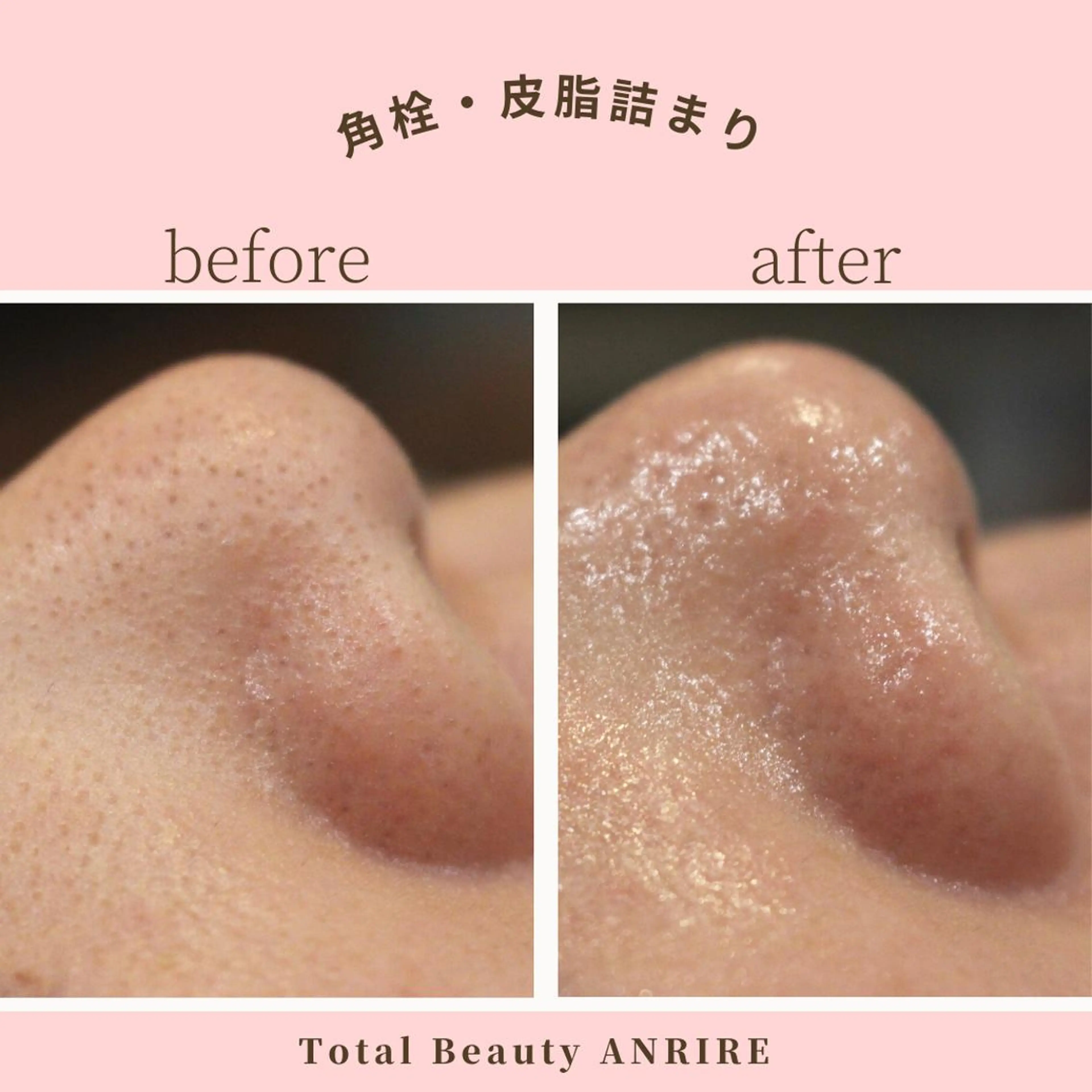 ANRIRE (アンリール)のエステ・リラクイメージ