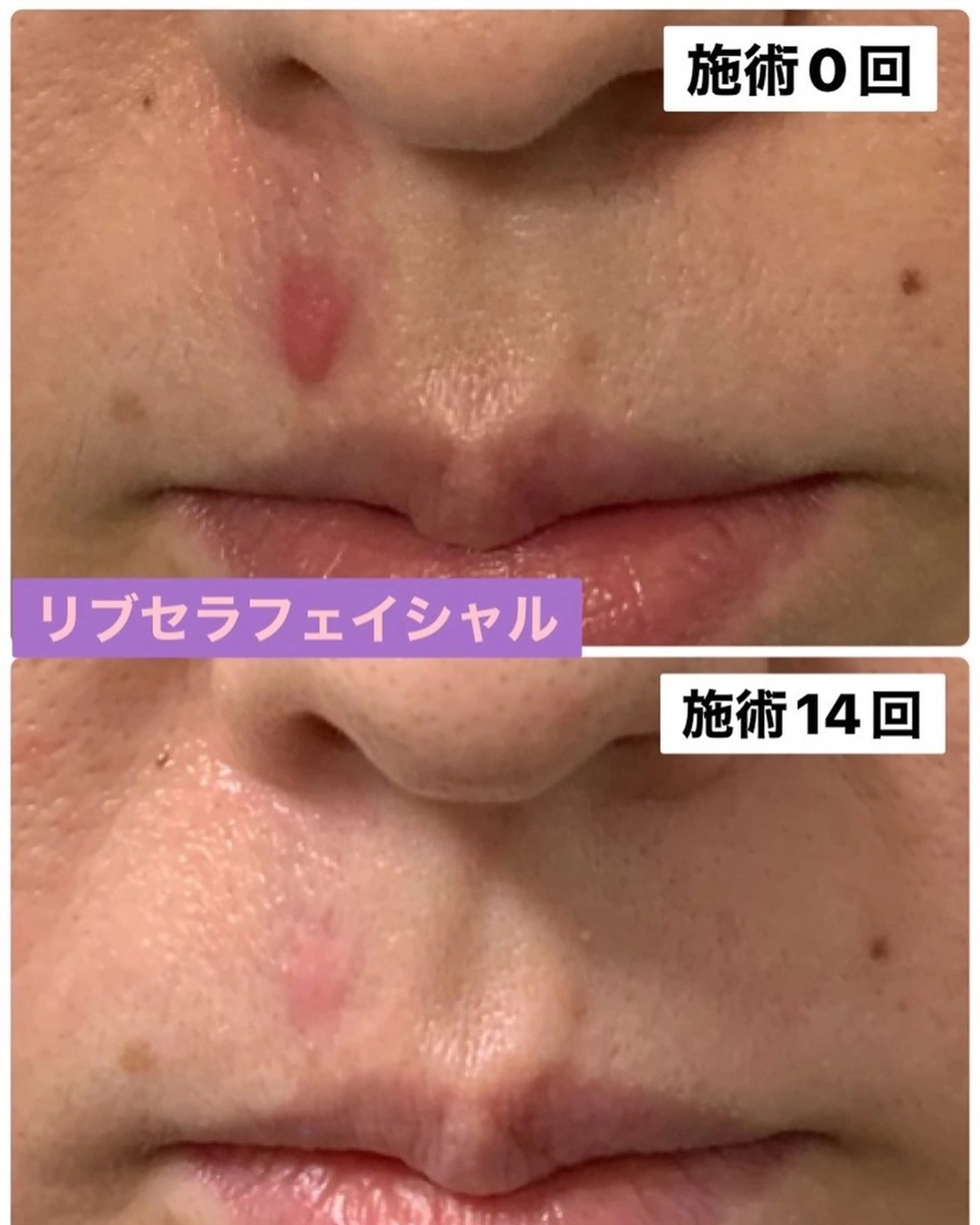 エステ プライベートサロン プリュネルのエステ・リラクイメージ