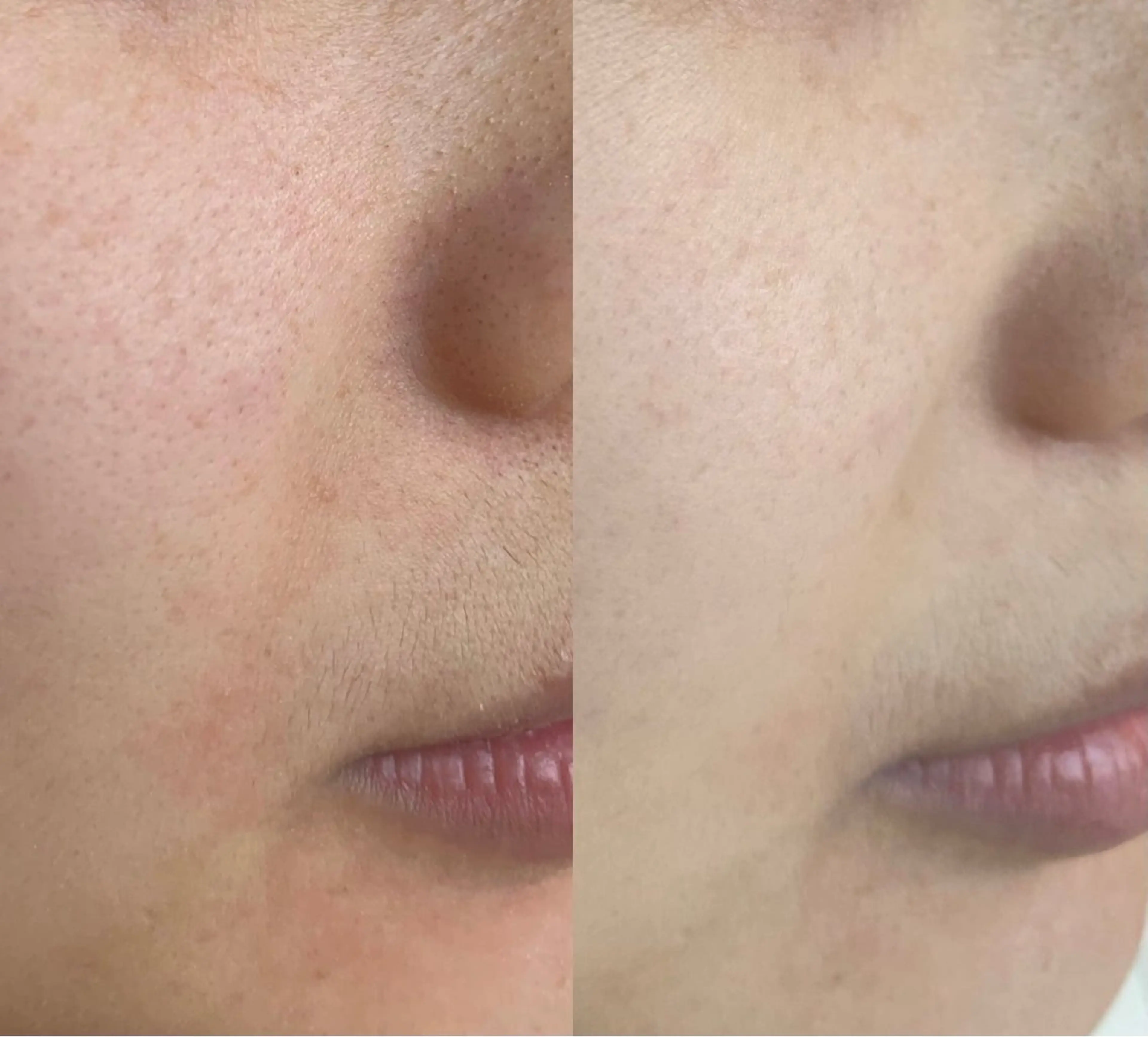 me coutureのマツエク・マツパデザイン