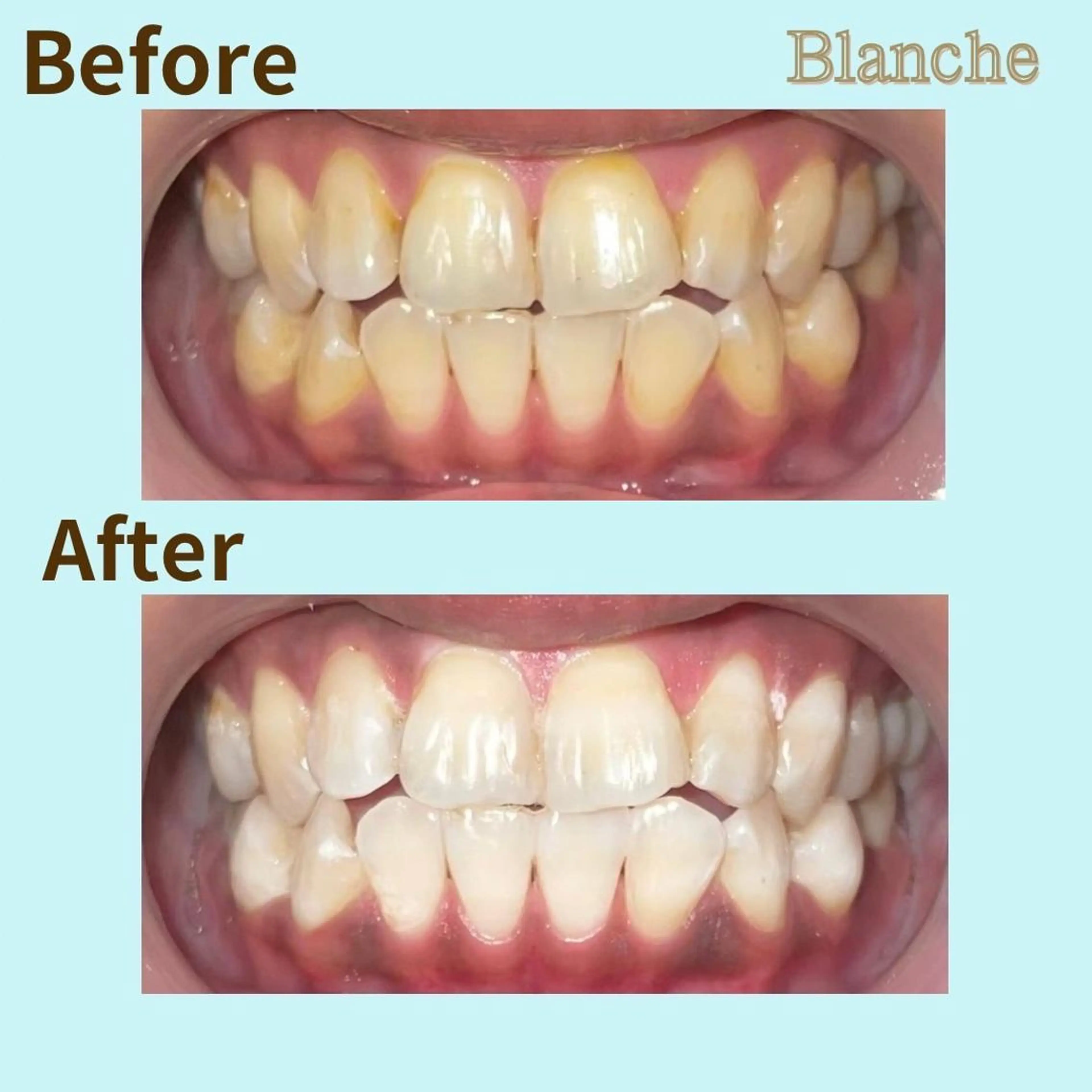 その他 Blanche 心斎橋のその他イメージ