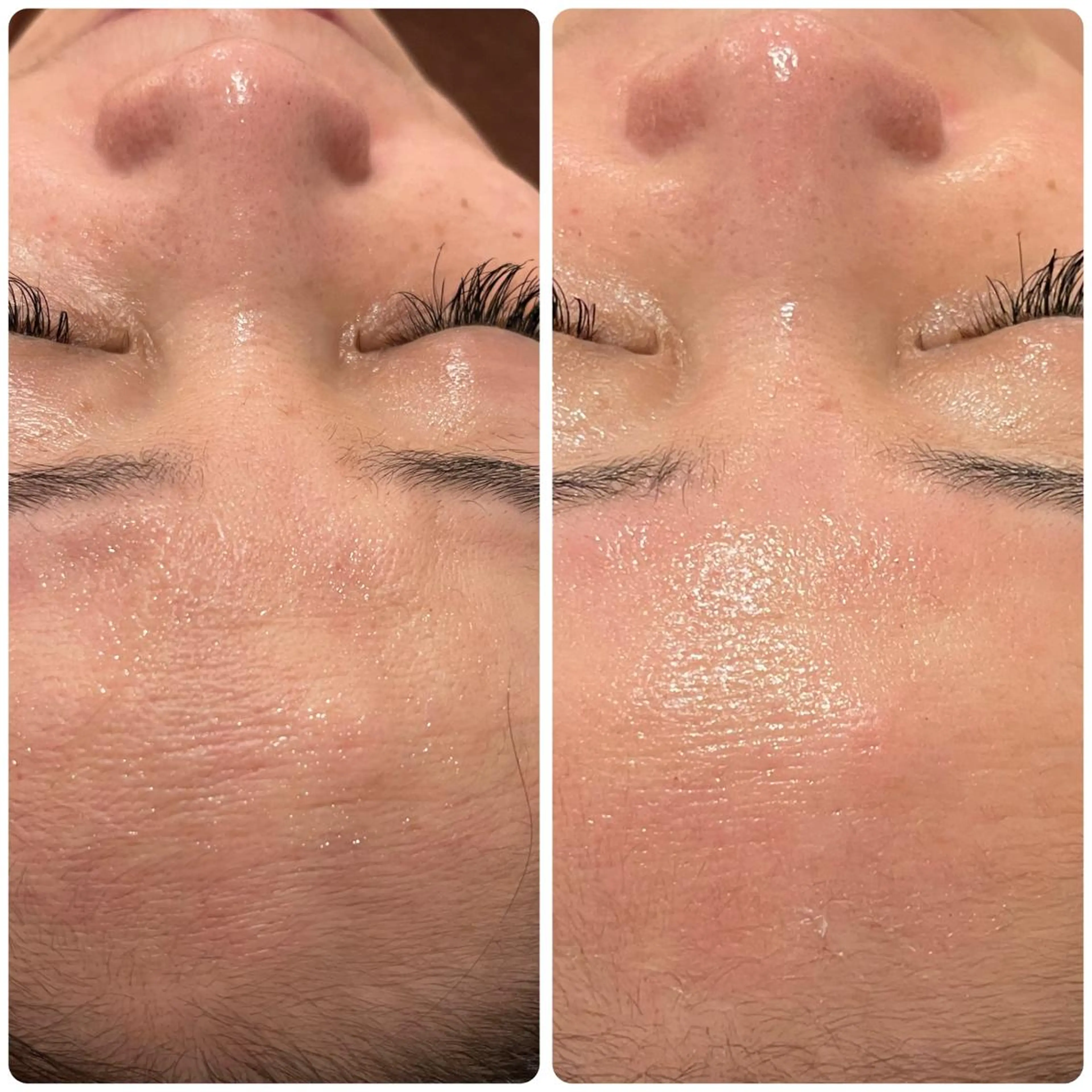 エステ リラク 立体小顔×艶肌×美ボ ディ似合わせ施術 岡のエステ・リラクイメージ