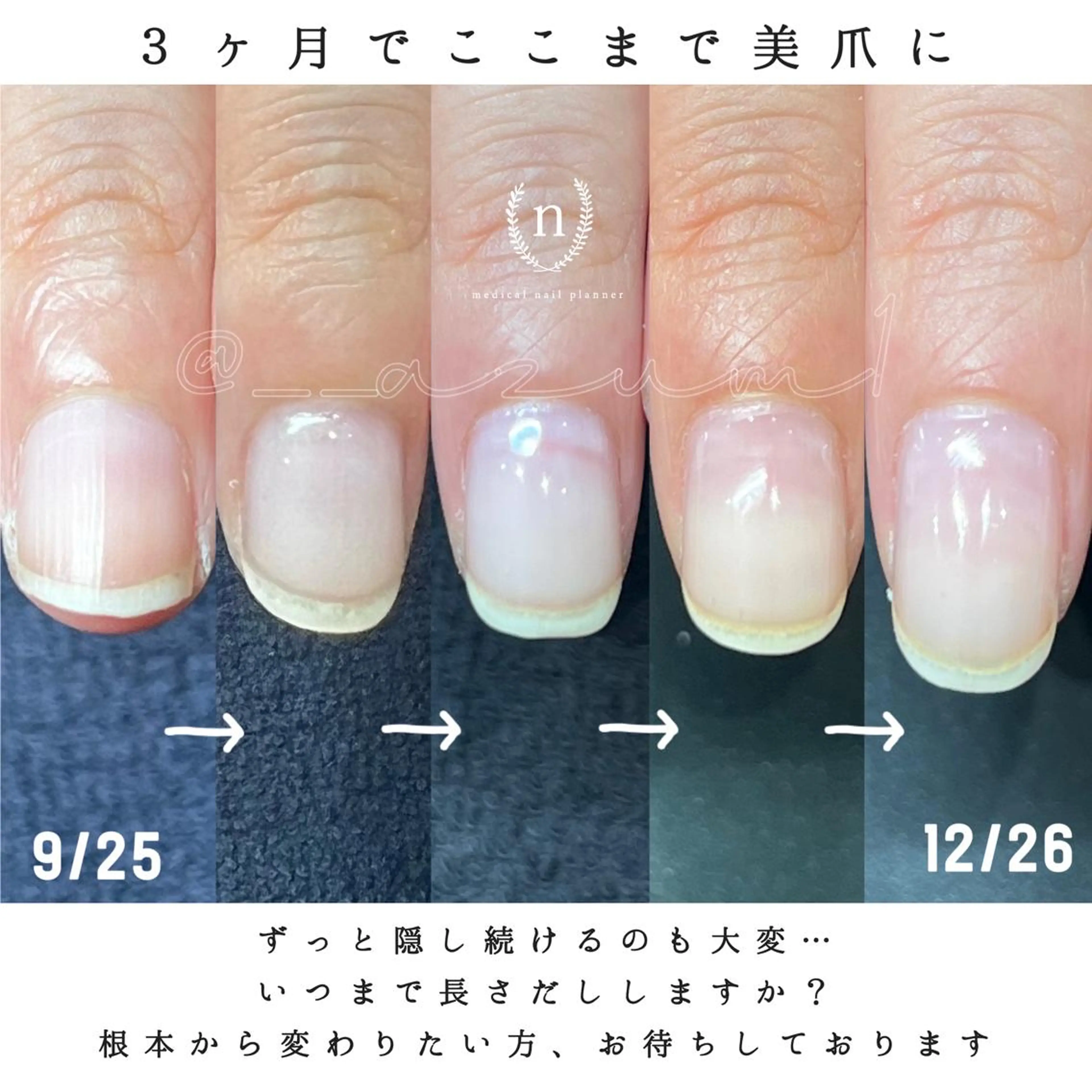 ネイル ハンドネイル nagi所属・自爪育成専門サロン ◌𓈒azumiのネイルデザイン