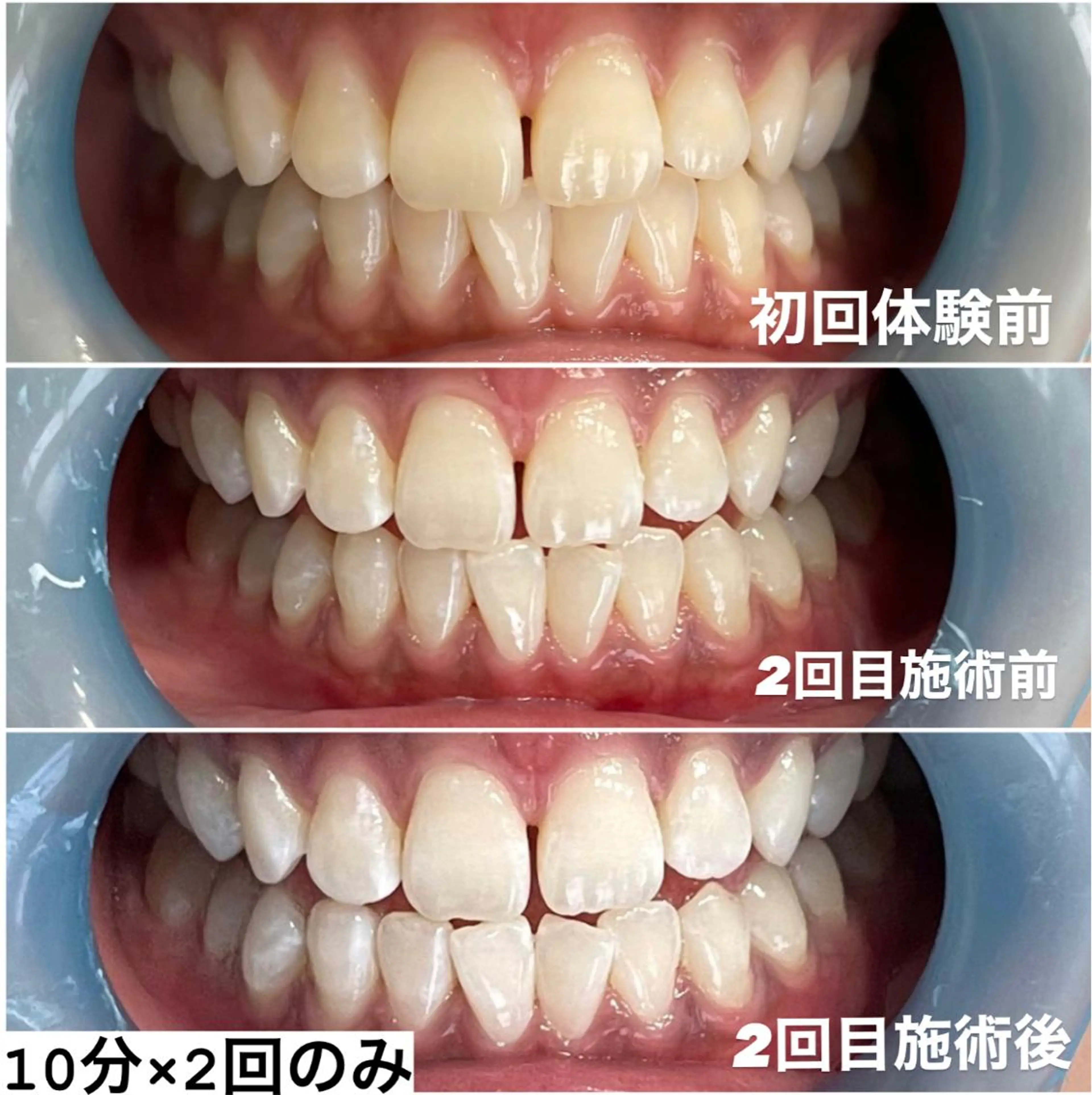 その他 ホワイトニング専門店 Hi-Whiteのその他イメージ