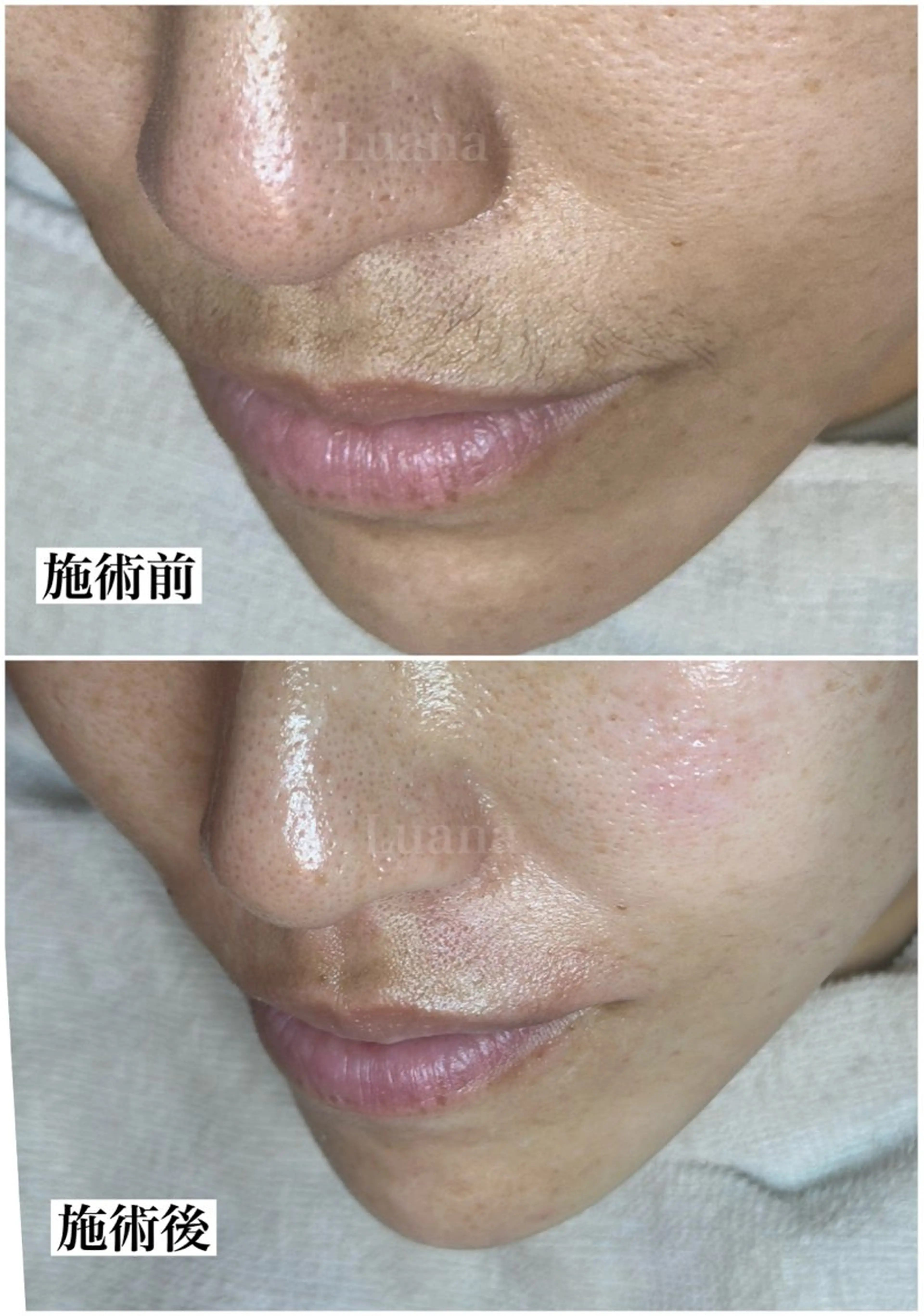 マツヤニWax専門/ 岸和田/Luanaのエステ・リラクイメージ