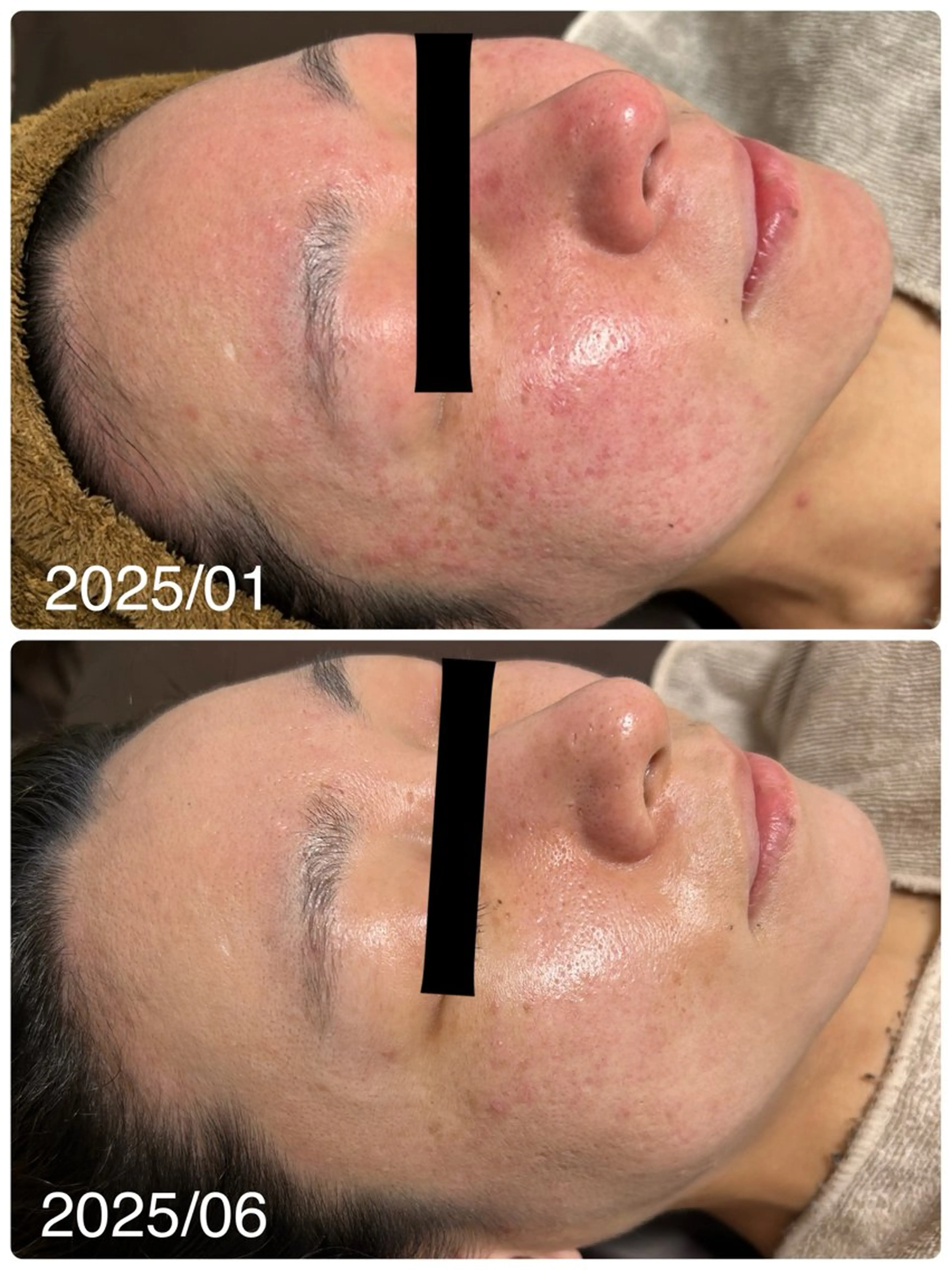 エステ REBORN by ami-goのその他イメージ