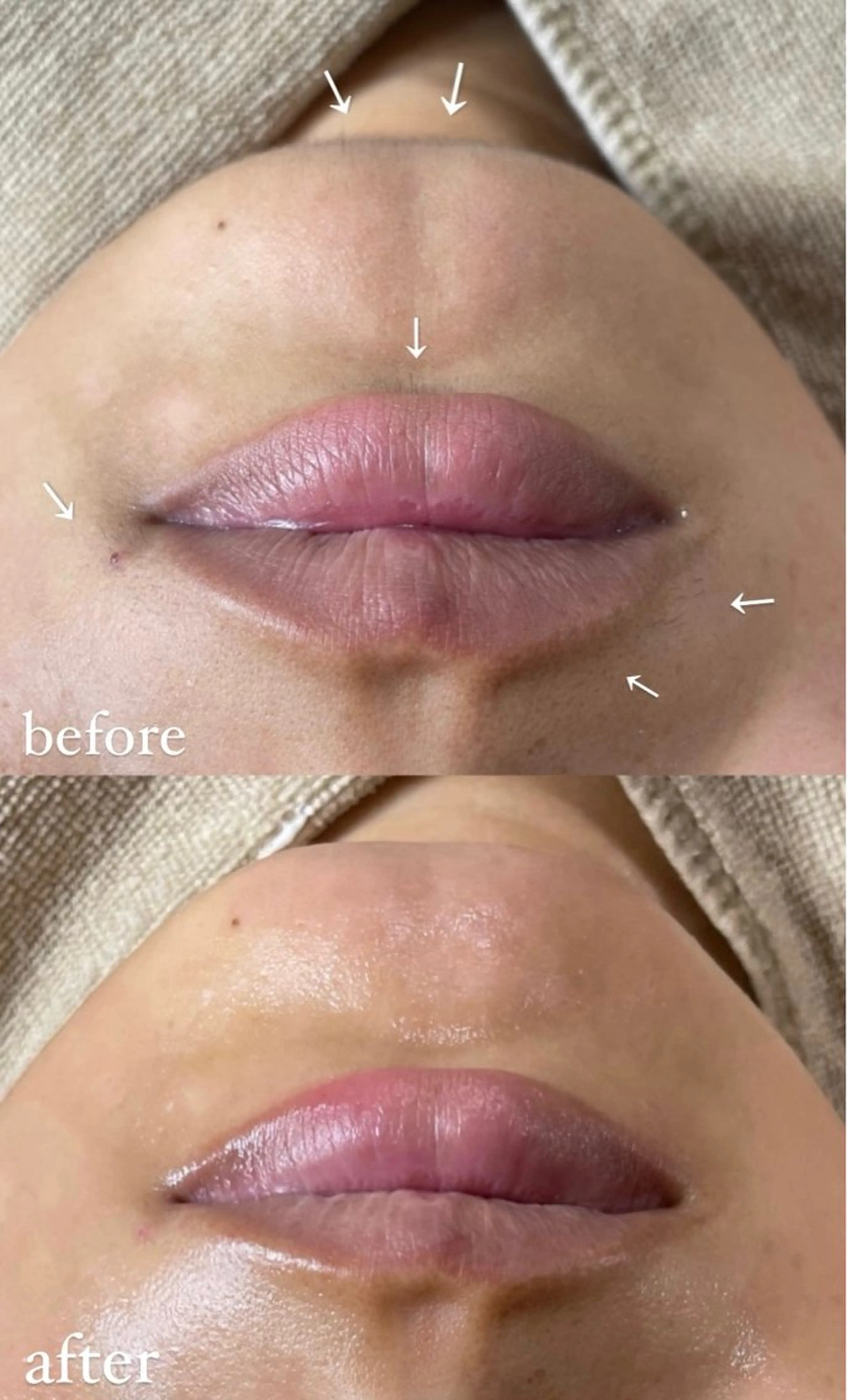 脱毛 エステサロン Mi-mi.iのエステ・リラクイメージ