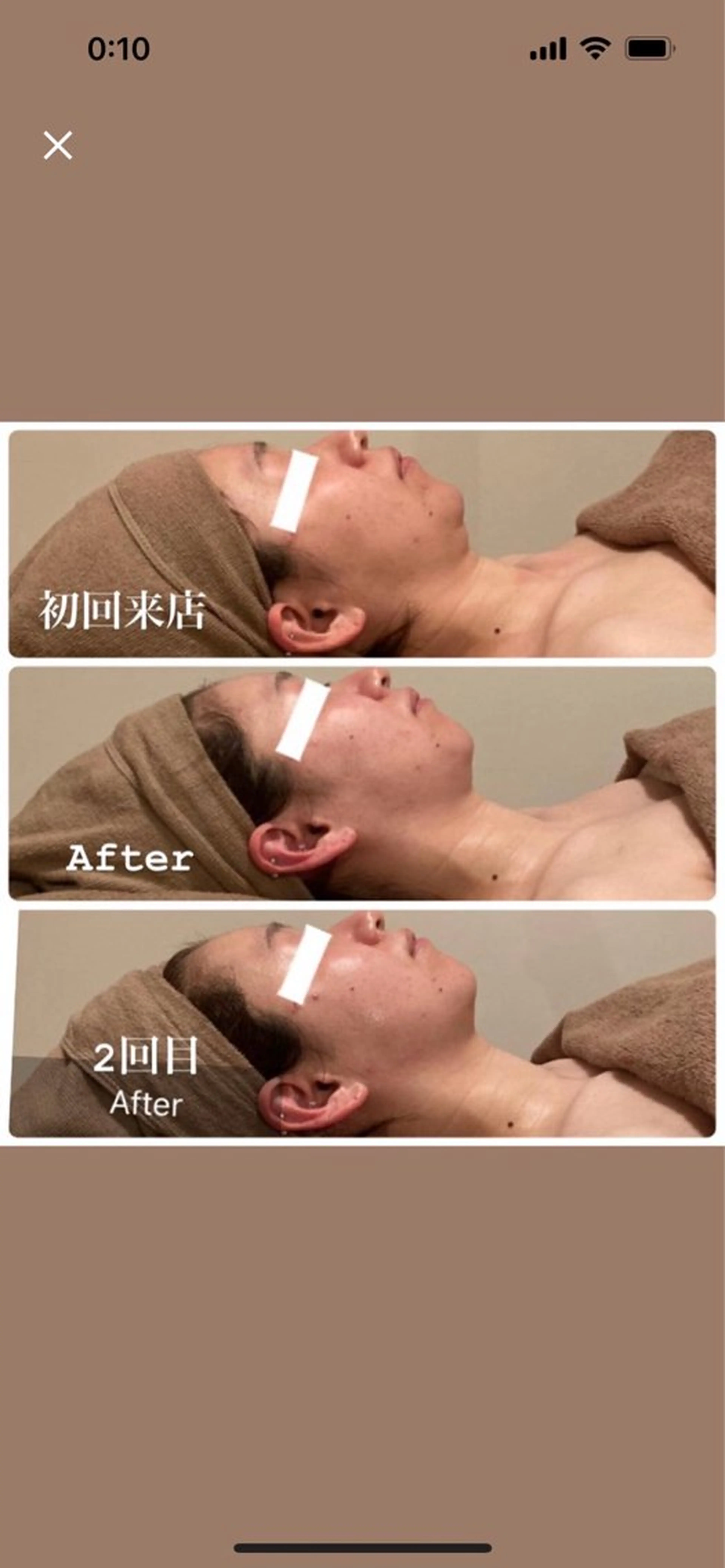 Ｂ&H所属・頭痛肩こり改善/小顔 サロンB&H心斎橋のエステ・リラクイメージ