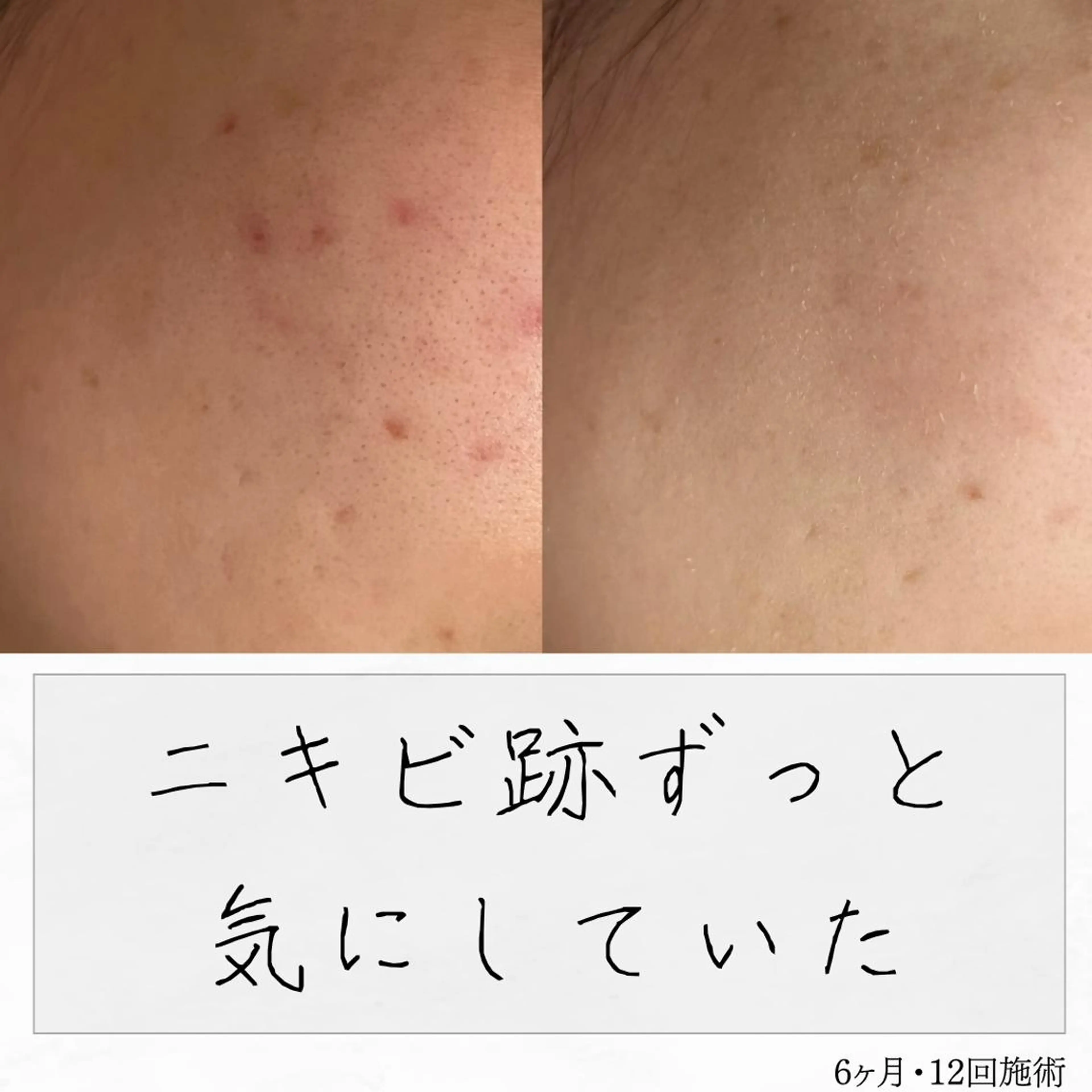 ニキビ経験者が施術 する専門サロン🌻のエステ・リラクイメージ